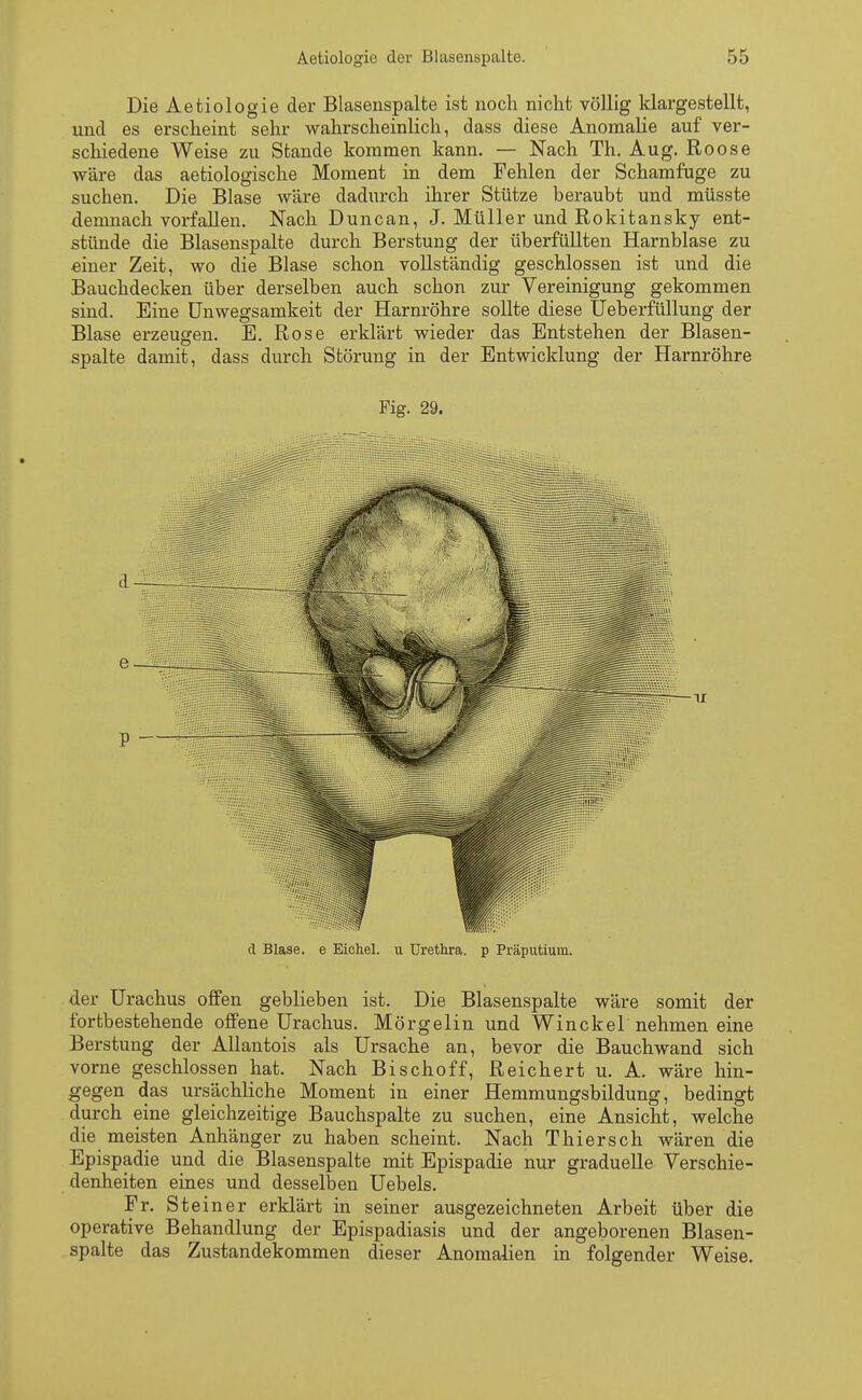 Die Aetiologie der Blasenspalte ist noch nicht völlig klargestellt, und es erscheint sehr wahrscheinlich, dass diese Anomalie auf ver- schiedene Weise zu Stande kommen kann. — Nach Th. Aug. Roose wäre das aetiologische Moment in dem Fehlen der Schamfuge zu suchen. Die Blase wäre dadurch ihrer Stütze beraubt und müsste demnach vorfallen. Nach Duncan, J. Müller und Rokitansky ent- stünde die Blasenspalte durch Berstung der überfüllten Harnblase zu einer Zeit, wo die Blase schon vollständig geschlossen ist und die Bauchdecken über derselben auch schon zur Vereinigung gekommen sind. Eine Unwegsamkeit der Harnröhre sollte diese Ueberfüllung der Blase erzeugen. E. Rose erklärt wieder das Entstehen der Blasen- spalte damit, dass durch Störung in der Entwicklung der Harnröhre Fig. 29. d Blase, e Eichel, u Urethra, p Präputium. der Urachus offen geblieben ist. Die Blasenspalte wäre somit der fortbestehende offene Urachus. Mörgelin und Win ekel nehmen eine Berstung der Allantois als Ursache an, bevor die Bauchwand sich vorne geschlossen hat. Nach Bischoff, Reichert u. A. wäre hin- gegen das ursächliche Moment in einer Hemmungsbildung, bedingt durch eine gleichzeitige Bauchspalte zu suchen, eine Ansicht, welche die meisten Anhänger zu haben scheint. Nach Thiersch wären die Epispadie und die Blasenspalte mit Epispadie nur graduelle Verschie- denheiten eines und desselben Uebels. Fr. St einer erklärt in seiner ausgezeichneten Arbeit über die operative Behandlung der Epispadiasis und der angeborenen Blasen- spalte das Zustandekommen dieser Anomalien in folgender Weise.