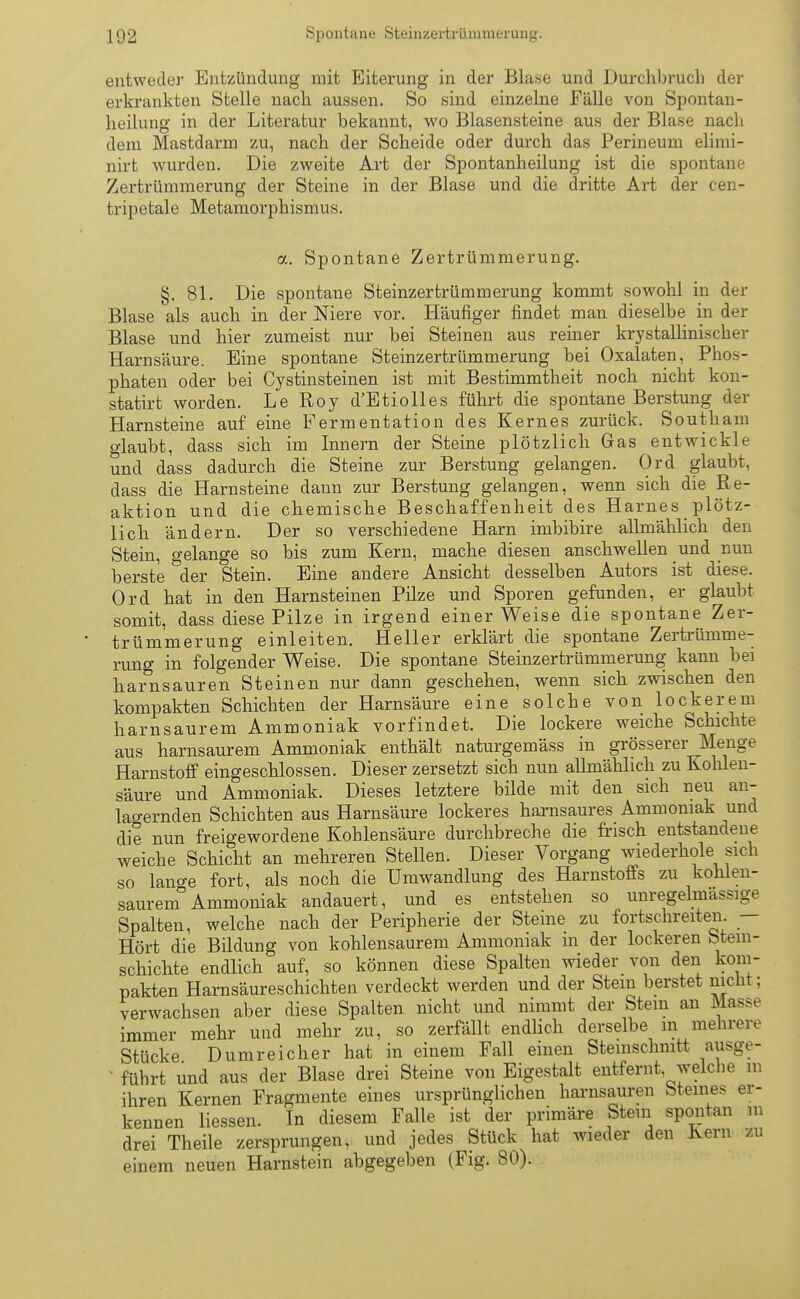 1Q2 Spontane Steinzertrüinmerun« entweder Entzündung mit Eiterung in der Blase und Durchbruch der erkrankten Stelle nach aussen. So sind einzelne Fälle von Spontan- heilung in der Literatur bekannt, wo Blasensteine aus der Blase nach dem Mastdarm zu, nach der Scheide oder durch das Perineum elimi- nirt wurden. Die zweite Art der Spontanheilung ist die spontane Zertrümmerung der Steine in der Blase und die dritte Art der cen- tripetale Metamorphismus. a. Spontane Zertrümmerung. §. 81. Die spontane Steinzertrümmerung kommt sowohl in der Blase als auch in der Niere vor. Häufiger findet man dieselbe in der Blase und hier zumeist nur bei Steinen aus reiner krystallinischer Harnsäure. Eine spontane Steinzertrümmerung bei Oxalaten, Phos- phaten oder bei Cystinsteinen ist mit Bestimmtheit noch nicht kon- statirt worden. Le Roy d'Etiolles führt die spontane Berstung der Harnsteine auf eine Fermentation des Kernes zurück. Southam glaubt, dass sich im Innern der Steine plötzlich Gas entwickle und dass dadurch die Steine zur Berstung gelangen. Ord glaubt, dass die Harnsteine dann zur Berstung gelangen, wenn sich die Re- aktion und die chemische Beschaffenheit des Harnes plötz- lich ändern. Der so verschiedene Harn imbibire allmählich den Stein, gelange so bis zum Kern, mache diesen anschwellen und nun berste der Stein. Eine andere Ansicht desselben Autors ist diese. Ord hat in den Harnsteinen Pilze und Sporen gefunden, er glaubt somit, dass diese Pilze in irgend einer Weise die spontane Zer- trümmerung einleiten. Heller erklärt die spontane Zertrümme- rung in folgender Weise. Die spontane Steinzertrümmerung kann bei harnsauren Steinen nur dann geschehen, wenn sich zwischen den kompakten Schichten der Harnsäure eine solche von lockerem harnsaurem Ammoniak vorfindet. Die lockere weiche Schichte aus harnsaurem Ammoniak enthält naturgemäss in grösserer Menge Harnstoff eingeschlossen. Dieser zersetzt sich nun allmählich zu Kohlen- säure und Ammoniak. Dieses letztere bilde mit den sich neu an- lagernden Schichten aus Harnsäure lockeres harnsaures Ammoniak und die nun freigewordene Kohlensäure durchbreche die frisch entstandene weiche Schicht an mehreren Stellen. Dieser Vorgang wiederhole sich so lallte fort, als noch die Umwandlung des Harnstoffs zu kohlen- saurem0 Ammoniak andauert, und es entstehen so unregelmassige Spalten, welche nach der Peripherie der Steine zu fortschreiten. — Hört die Bildung von kohlensaurem Ammoniak in der lockeren Stem- schichte endlich auf, so können diese Spalten wieder von den kom- pakten Harnsäureschichten verdeckt werden und der Stein berstet nicht; verwachsen aber diese Spalten nicht und nimmt der Stein an Masse immer mehr und mehr zu, so zerfällt endlich derselbe m mehrere Stücke Dumreicher hat in einem Fall einen Steinschnitt ausge- führt und aus der Blase drei Steine von Eigestalt entfernt welche m ihren Kernen Fragmente eines ursprünglichen harnsauren Steines er- kennen Hessen. In diesem Falle ist der primäre Stein spontan m drei Theile zersprungen, und jedes Stück hat wieder den Kern zu einem neuen Harnstein abgegeben (Fig. 80).
