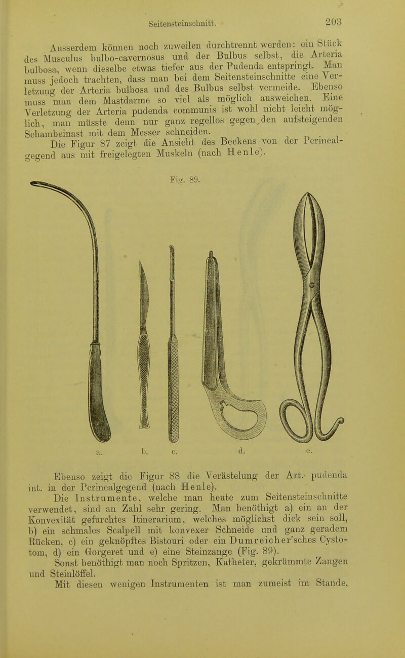 Ausserdem können noch zuweilen durchtrennt werden: ein Stück des Musculus bulbo-cavernosus und der Bulbus selbst, die Axtena bulbosa, wenn dieselbe etwas tiefer aus der Pudenda entspringt. Man muss jedoch trachten, dass man bei dem Seitenstemschnitte eine Ver- Letzung der Arteria bulbosa und des Bulbus selbst vermeide. Ebenso muss man dem Mastdarme so viel als möglich ausweichen. Eine Verletzung der Arteria pudenda communis ist wohl nicht leicht mög- lich, man müsste denn nur ganz regellos gegen.den aufsteigenden Schambeinast mit dem Messer schneiden. Die Figur 87 zeigt die Ansicht des Beckens von der Permeal- gegend aus mit freigelegten Muskeln (nach He nie). Fiy. 89. Ebenso zeigt die Figur 88 die Verästelung der Art, pudenda int. in der Perinealgegend (nach He nie). Die Instrumente, welche man heute zum Seitenstemschnitte verwendet, sind an Zahl sehr gering. Man benöthigt a) ein an der Konvexität gefurchtes Itinerarium, welches möglichst dick sein soll, b) ein schmales Scalpell mit konvexer Schneide und ganz geradem Rücken, c) ein geknöpftes Bistouri oder ein Dumreicher'sches Cysto- tom, d) ein Gorgeret und e) eine Steinzange (Fig. 89). Sonst benöthigt man noch Spritzen, Katheter, gekrümmte Zangen und Steinlöffel. Mit diesen wenigen Instrumenten ist man zumeist im Stande,