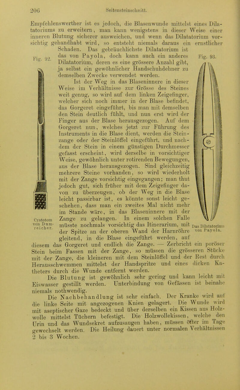 Fig. 92. Fig. 93. Empfehlenswerther ist es jedoch, die Blasenwunde mittelst eines Dila- tatoriums zu erweitern , man kann wenigstens in dieser Weise einer inneren Blutung sicherer ausweichen, und wenn das Dilatatorium vor- sichtig gehandhabt wird, so entsteht niemals daraus ein ernstlicher Schaden. Das gebräuchlichste Dilatatorium ist das von Payola, doch kann auch ein anderes Dilatatorium, deren es eine grössere Anzahl gibt, ja selbst ein gewöhnlicher Handschuhdehner zu demselben Zwecke verwendet werden. Ist der Weg in das Blaseninnere in dieser Weise im Verhältnisse zur Grösse des Steines weit genug, so wird auf dem linken Zeigefinger, welcher sich noch immer in der Blase befindet, das Gorgeret eingeführt, bis man mit demselben den Stein deutlich fühlt, und nun erst wird der Finger aus der Blase herausgezogen. Auf dem Gorgeret nun, welches jetzt zur Führung des Instruments in die Blase dient, werden die Stein - zange oder der Steinlöffel eingeführt, und nach- dem der Stein in einem günstigen Durchmesser gefasst erscheint, wird derselbe in vorsichtiger Weise, gewöhnlich unter rotirenden Bewegungen, aus der Blase herausgezogen. Sind gleichzeitig mehrere Steine vorhanden, so wird wiederholt mit der Zange vorsichtig eingegangen; man thut jedoch gut, sich früher mit dem Zeigefinger da- von zu überzeugen, ob der Weg in die Blase leicht passirbar ist, es könnte sonst leicht ge- schehen, dass man ein zweites Mal nicht mehr im Stande wäre, in das Blaseninnere mit der Zange zu gelangen. In einem solchen Falle müsste nochmals vorsichtig das Itinerarium, mit Das Di]atatoriui!: der Spitze an der oberen Wand der Harnröhre ™n Payola. gleitend, in die Blase eingeführt werden, auf diesem das Gorgeret und endlich die Zange. — Zerbricht ein poröser Stein beim Fassen mit der Zange, so müssen die grösseren Stücke mit der Zange, die kleineren mit dem Steinlöffel und der Rest durch Herausschwemmen mittelst der Handspritze und eines dicken Ka- theters durch die Wunde entfernt werden. Die Blutung ist gewöhnlich sehr gering und kann leicht mit Eiswasser gestillt werden. Unterbindung von Gefässen ist beinah»' niemals nothwendig. Die Nachbehandlung ist sehr einfach. Der Kranke wird auf die linke Seite mit angezogenen Knien gelagert. Die Wunde wird mit aseptischer Gaze bedeckt und über derselben ein Kissen aus Holz- wolle mittelst Tüchern befestigt. Die Holzwollekissen, welche den Urin und das Wundsekret aufzusaugen haben, müssen öfter im Tage gewechselt werden. Die Heilung dauert unter normalen Verhältnissen 2 bis 3 Wochen. Cystotom von DHin- reiche r.