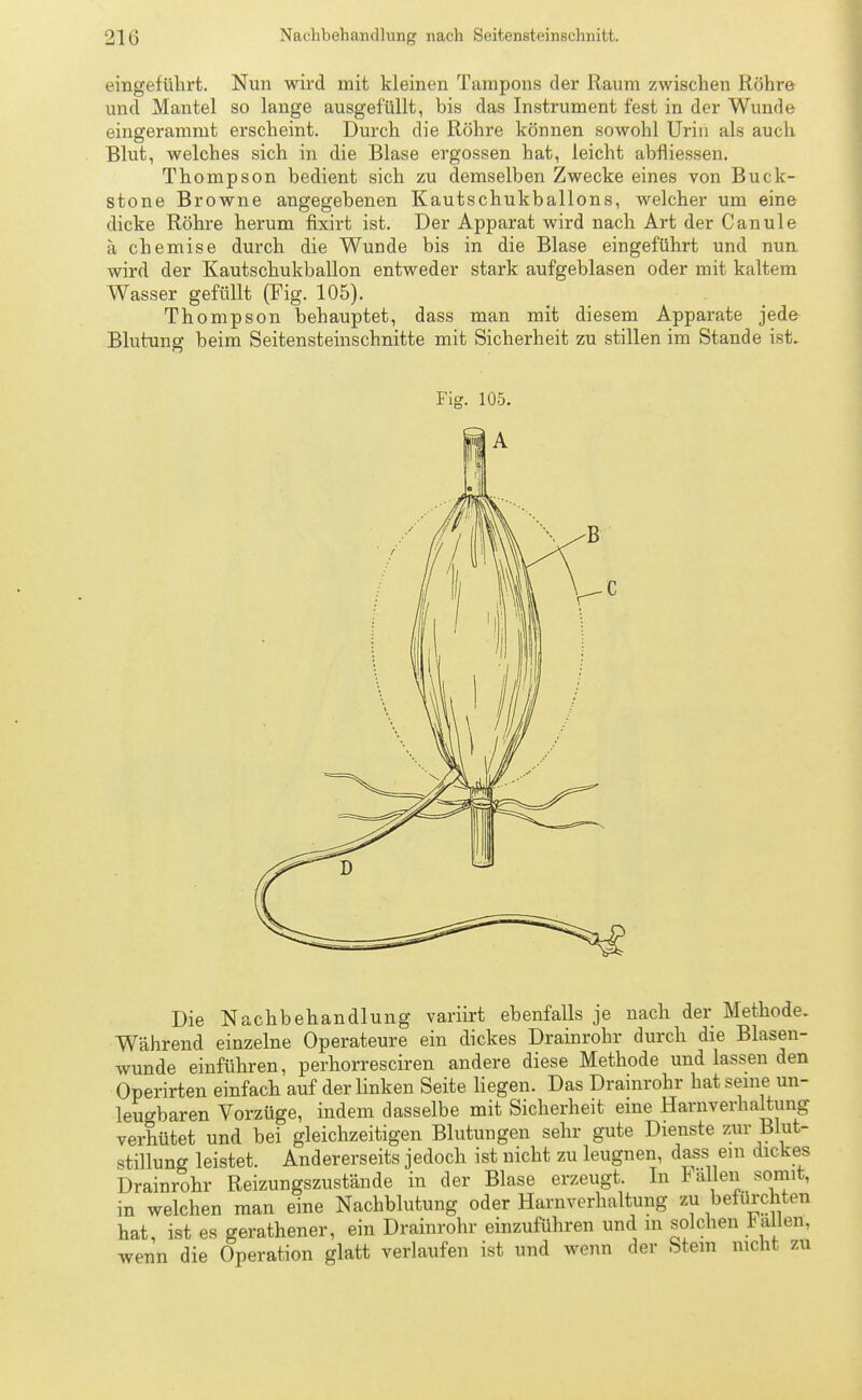 eingeführt. Nun wird mit kleinen Tampons der Raum zwischen Röhre und Mantel so lange ausgefüllt, bis das Instrument fest in der Wunde eingerammt erscheint. Durch die Röhre können sowohl Urin als auch Blut, welches sich in die Blase ergossen hat, leicht abfliessen. Thompson bedient sich zu demselben Zwecke eines von Buck- stone Browne angegebenen Kautschukballons, welcher um eine dicke Röhre herum fixirt ist. Der Apparat wird nach Art der Canule ä chemise durch die Wunde bis in die Blase eingeführt und nun wird der Kautschukballon entweder stark aufgeblasen oder mit kaltem Wasser gefüllt (Fig. 105). Thompson behauptet, dass man mit diesem Apparate jede Blutung beim Seitensteinschnitte mit Sicherheit zu stillen im Stande ist. Fig. 105. Die Nachbehandlung variirt ebenfalls je nach der Methode. Während einzelne Operateure ein dickes Drainrohr durch die Blasen- wunde einführen, perhorresciren andere diese Methode und lassen den Operirten einfach auf der linken Seite liegen. Das Drainrohr hat seine un- leugbaren Vorzüge, indem dasselbe mit Sicherheit eine Harnverhaltung verhütet und bei gleichzeitigen Blutungen sehr gute Dienste zur Blut- stillung leistet. Andererseits jedoch ist nicht zu leugnen, dass em dickes Drainrohr Reizungszustände in der Blase erzeugt. In t allen somit, in welchen man eine Nachblutung oder Harnverhaltung zu befürchten hat, ist es gerathener, ein Drainrohr einzuführen und in solchen h allen, wenn die Operation glatt verlaufen ist und wenn der Stein nicht zu