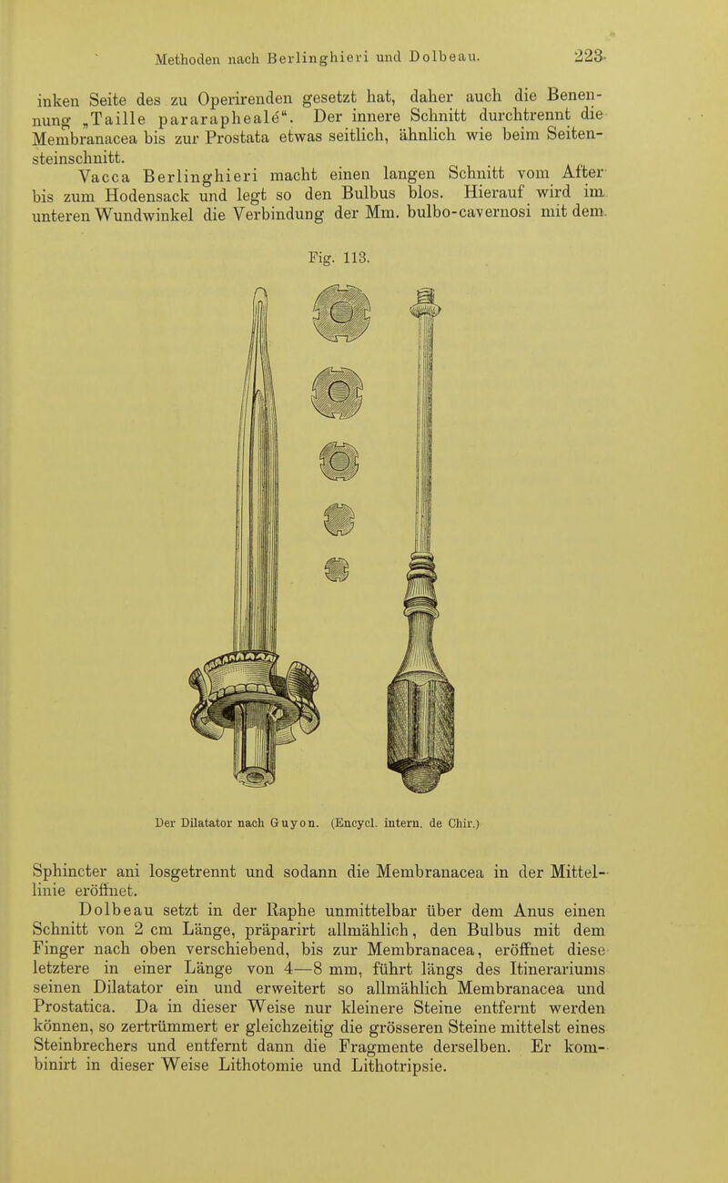 inken Seite des zu Operirenden gesetzt hat, daher auch die Benen- nung „Taille pararapheale. Der innere Schnitt durchtrennt die Membranacea bis zur Prostata etwas seitlich, ähnlich wie beim Seiten- steinschnitt. Vacca Berlinghieri macht einen langen Schnitt vom After bis zum Hodensack und legt so den Bulbus blos. Hierauf wird im unteren Wundwinkel die Verbindung der Mm. bulbo-cavernosi mit dem. Sphincter ani losgetrennt und sodann die Membranacea in der Mittel- linie eröffnet. Dolbeau setzt in der Raphe unmittelbar über dem Anus einen Schnitt von 2 cm Länge, präparirt allmählich, den Bulbus mit dem Finger nach oben verschiebend, bis zur Membranacea, eröffnet diese letztere in einer Länge von 4—8 mm, führt längs des Itinerariums seinen Diktator ein und erweitert so allmählich Membranacea und Prostatica. Da in dieser Weise nur kleinere Steine entfernt werden können, so zertrümmert er gleichzeitig die grösseren Steine mittelst eines Steinbrechers und entfernt dann die Fragmente derselben. Er kom- binirt in dieser Weise Lithotomie und Lithotripsie. Fig. 113. Der Dilatator nach Guyon. (Encycl. intern, de Chir.)