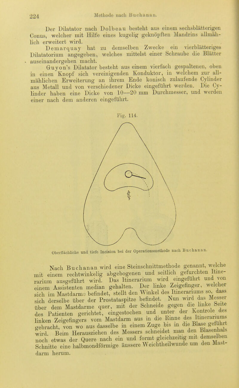 221 Methode nach Buch an an. Der Diktator nach Dolbeau besteht aus einem sechsblätterigen Conus, welcher mit Hilfe eines kugelig geknöpften Mandrins allmäh- lich erweitert wird. Demarquay hat zu demselben Zwecke ein vierblätteriges Dilatatorium angegeben, welches mittelst einer Schraube die Blätter - auseinandergehen macht. Guyon's Diktator besteht aus einem vierfach gespaltenen, oben in einen Knopf sich vereinigenden Konduktor, in welchem zur all- mählichen Erweiterung an ihrem Ende konisch zulaufende Cylinder aus Metall und von verschiedener Dicke eingeführt werden. Die Cy- linder haben eine Dicke von 10—20 mm Durchmesser, und werden einer nach dem anderen eingeführt. Fig. 114. Oberflächliche und tiefe Incision bei der Operationsinethode nach Buchanau. Nach Buchanan wird eine Steinschnittmethode genannt, welche mit einem rechtwinkelig abgebogenen und seitlich gefurchten Itine- rarium ausgeführt wird. Das Itinerarium wird eingeführt und von einem Assistenten median gehalten. Der linke Zeigefinger, welcher sich im Mastdarm, befindet, stellt den Winkel des Itmerariums so dass sich derselbe über der Prostataspitze befindet. Nun wird das Messer über dem Mastdarme quer, mit der Schneide gegen die lmke Seite des Patienten gerichtet, eingestochen und unter der Kontrole des linken Zeigefingers vom Mastdarm aus in die Rinne des Itinerarium. gebracht, ?on wo aus dasselbe in einem Zuge bis in die Blase gefuhr wird Beim Herausziehen des Messers schneidet man den Blasenhai* noch etwas der Quere nach ein und formt gleichzeitig mit demselben Schnitte eine halbmondförmige äussere Weichtheilwunde um den Mast- darm herum.
