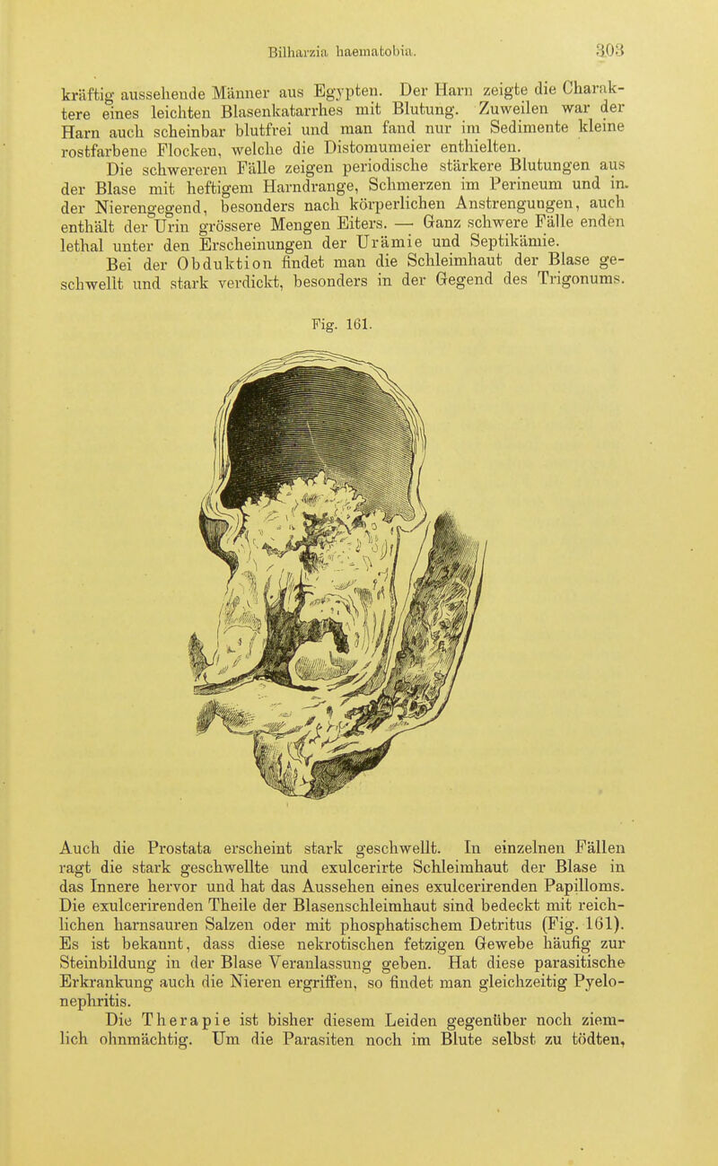 Bilharzia haematol>i;i. kräftig aussehende Männer aus Egypten. Der Harn zeigte die Charak- tere eines leichten Blasenkatarrhes mit Blutung. Zuweilen war der Harn auch scheinbar blutfrei und man fand nur im Sedimente kleine rostfarbene Flocken, welche die Distomumeier enthielten. Die schwereren Fälle zeigen periodische stärkere Blutungen aus der Blase mit heftigem Harndrange, Schmerzen im Perineum und in. der Nierengegend, besonders nach körperlichen Anstrengungen, auch enthält der Urin grössere Mengen Eiters. — Ganz schwere Fälle enden lethal unter den Erscheinungen der Urämie und Septikämie. Bei der Obduktion findet man die Schleimhaut der Blase ge- schwellt und stark verdickt, besonders in der Gegend des Trigonums. Fig. 161. Auch die Prostata erscheint stark geschwellt. In einzelnen Fällen ragt die stark geschwellte und exulcerirte Schleimhaut der Blase in das Innere hervor und hat das Aussehen eines exulcerirenden Papilloms. Die exulcerirenden Theile der Blasenschleimhaut sind bedeckt mit reich- lichen harnsauren Salzen oder mit phosphatischem Detritus (Fig. 161). Es ist bekannt, dass diese nekrotischen fetzigen Gewebe häufig zur Steinbildung in der Blase Veranlassung geben. Hat diese parasitische Erkrankung auch die Nieren ergriffen, so findet man gleichzeitig Pyelo- nephritis. Die Therapie ist bisher diesem Leiden gegenüber noch ziem- lich ohnmächtig. Um die Parasiten noch im Blute selbst zu tödten,