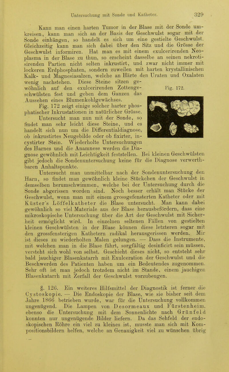 Kann man einen harten Tumor in der Blase mit der Sonde um- kreisen, kann man sich an der Basis der Geschwulst sogar mit der Sonde einhängen, so handelt es sich um eine gestielte Geschwulst. Gleichzeitig kann man sich dabei über den Sitz und die Grösse der Geschwulst informiren. Hat man es mit einem exulcerirenden Neo- plasma in der Blase zu thun, so erscheint dasselbe an seinen nekroti- sirenden Partien nicht selten inkrustirt, und zwar nicht immer mit lockeren Erdphosphaten, sondern zuweilen mit harten krystallinischen Kalk- und Magnesiasalzen, welche an Härte den Uraten und Oxalaten wenig nachstehen. Diese Steine sitzen ge- wöhnlich auf den exulcerirenden Zottenge- schwülsten fest und geben dem Ganzen das Aussehen eines Blumenkohlgewächses. Fig. 172 zeigt einige solcher harter phos- phatischer Inkrustationen in natürlicher Grösse. Untersucht man nun mit der Sonde, so findet man sehr leicht diese Steine, und es handelt sich nun um die Differentialdiagnose, ob inkrustirtes Neugebilde oder ob fixirter, in- cystirter Stein. Wiederholte Untersuchungen des Harnes und die Anamnese werden die Dia- gnose gewöhnlich mit Leichtigkeit feststellen. Bei kleinen Geschwülsten gibt jedoch die Sondenuntersuchung keine für die Diagnose verwert- baren Anhaltspunkte. Untersucht man unmittelbar nach der Sondenuntersuchung den Harn, so findet man gewöhnlich kleine Stückchen der Geschwulst in demselben herumschwimmen, welche bei der Untersuchung durch die Sonde abgerissen worden sind. Noch besser erhält man Stücke der Geschwulst, wenn man mit einem grossgefensterten Katheter oder mit Küster's Löffelkatheter die Blase untersucht. Man kann dabei gewöhnlich so viel Materiale aus der Blase herausbefördern, dass eine mikroskopische Untersuchung über die Art der Geschwulst mit Sicher- heit ermöglicht wird. In einzelnen seltenen Fällen von gestielten kleinen Geschwülsten in der Blase können diese letzteren sogar mit den grossfensterigen Kathetern radikal herausgerissen werden. Mir ist dieses zu wiederholten Malen gelungen. — Dass die Instrumente, mit welchen man in die Blase fährt, sorgfältig desinficirt sein müssen, versteht sich wohl von selbst. Geschieht dieses nicht, so entsteht, sehr bald jauchiger Blasenkatarrh mit Exulceration der Geschwulst und die Beschwerden des Patienten haben um ein Bedeutendes zugenommen. Sehr oft ist man jedoch trotzdem nicht im Stande, einem jauchigen Blasenkatarrh mit Zerfall der Geschwulst vorzubeugen. §. 12G. Ein weiteres Hilfsmittel der Diagnostik ist ferner die Cystoskopie. — Die Endoskopie der Blase, wie sie bisher seit dem Jahre 1866 betrieben wurde, war für die Untersuchung vollkommen ungenügend. Die Lampen von Desormeaux und Fürstenheim, ebenso die Untersuchung mit dem Sonnenlichte nach Grünfeld konnten nur ungenügende Bilder liefern. Da das Sehfeld der endo- skopischen Röhre ein viel zu kleines ist, musste man sich mit Kom- positionsbildern helfen, welche an Genauigkeit viel zu wünschen übrig Fig. 172.