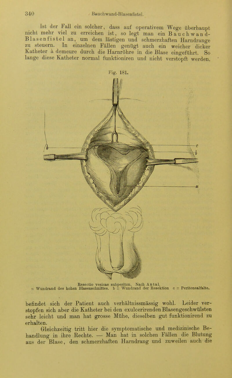 Ist der Fall ein solcher, dass auf operativem Wege überhaupt nicht mehr viel zu erreichen ist, so legt mau ein Bauchwand- Blasenfistel an, um dem lästigen und schmerzhaften Harndrange zu steuern. In einzelnen Fällen genügt auch ein weicher dicker Katheter ä demeure durch die Harnröhre in die Blase eingeführt. So lange diese Katheter normal funktioniren und nicht verstopft werden. Fig. 181. Resectio vesicae subperiton. Nach Antal. = Wundrand des hohen Blasenschnittes, b = Wundrand der Resektion c = Peritonealfalte. befindet sich der Patient auch verhältnissmässig wohl. Leider ver- stopfen sich aber die Katheter bei den exulcerirenden Blasengeschwülsten sehr leicht und man hat grosse Mühe, dieselben gut funktionirend zu erhalten. Gleichzeitig tritt hier die symptomatische und medizinische Be- handlung in ihre Rechte. — Man hat in solchen Fällen die Blutung aus der Blase, den schmerzhaften Harndrang und zuweilen auch die