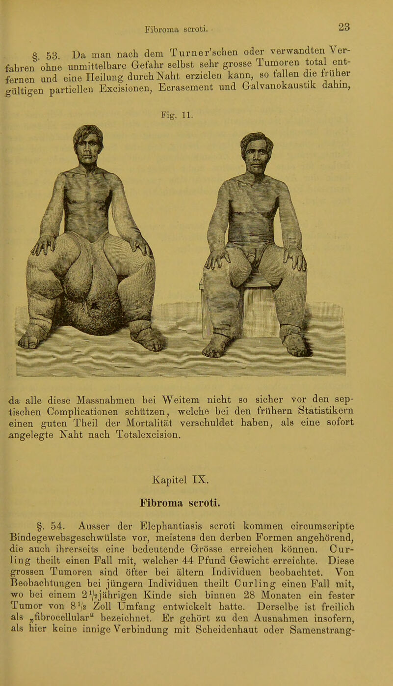 Fibroma scroti. S 53 Da man nach dem Turner'schen oder verwandten Ver- fahren ohne unmittelbare Gefahr selbst sehr grosse Tumoren total ent- fernen und eine Heilung durch Naht erzielen kann, so fallen die früher gülti°-en partiellen Excisionen, Ecrasement und Galvanokaustik dahin, Fig. 11. da alle diese Massnahmen bei Weitem nicht so sicher vor den sep- tischen Complicationen schützen, welche bei den frühern Statistikern einen guten Theil der Mortalität verschuldet haben, als eine sofort angelegte Naht nach Totalexcision. Kapitel IX. Fibroma scroti. §. 54. Ausser der Elephantiasis scroti kommen circumscripte Bindegewebsgeschwülste vor, meistens den derben Formen angehörend, die auch ihrerseits eine bedeutende Grösse erreichen können. Cur- ling theilt einen Fall mit, welcher 44 Pfund Gewicht erreichte. Diese grossen Tumoren sind öfter bei altern Individuen beobachtet. Von Beobachtungen bei Jüngern Individuen theilt Curling einen Fall mit, wo bei einem 2^/2jährigen Kinde sich binnen 28 Monaten ein fester Tumor von 8V2 Zoll Umfang entwickelt hatte. Derselbe ist freilich als „fibrocellnlar bezeichnet. Er gehört zu den Ausnahmen insofern, als hier keine innige Verbindung mit Scheidenhaut oder Samenstrang-