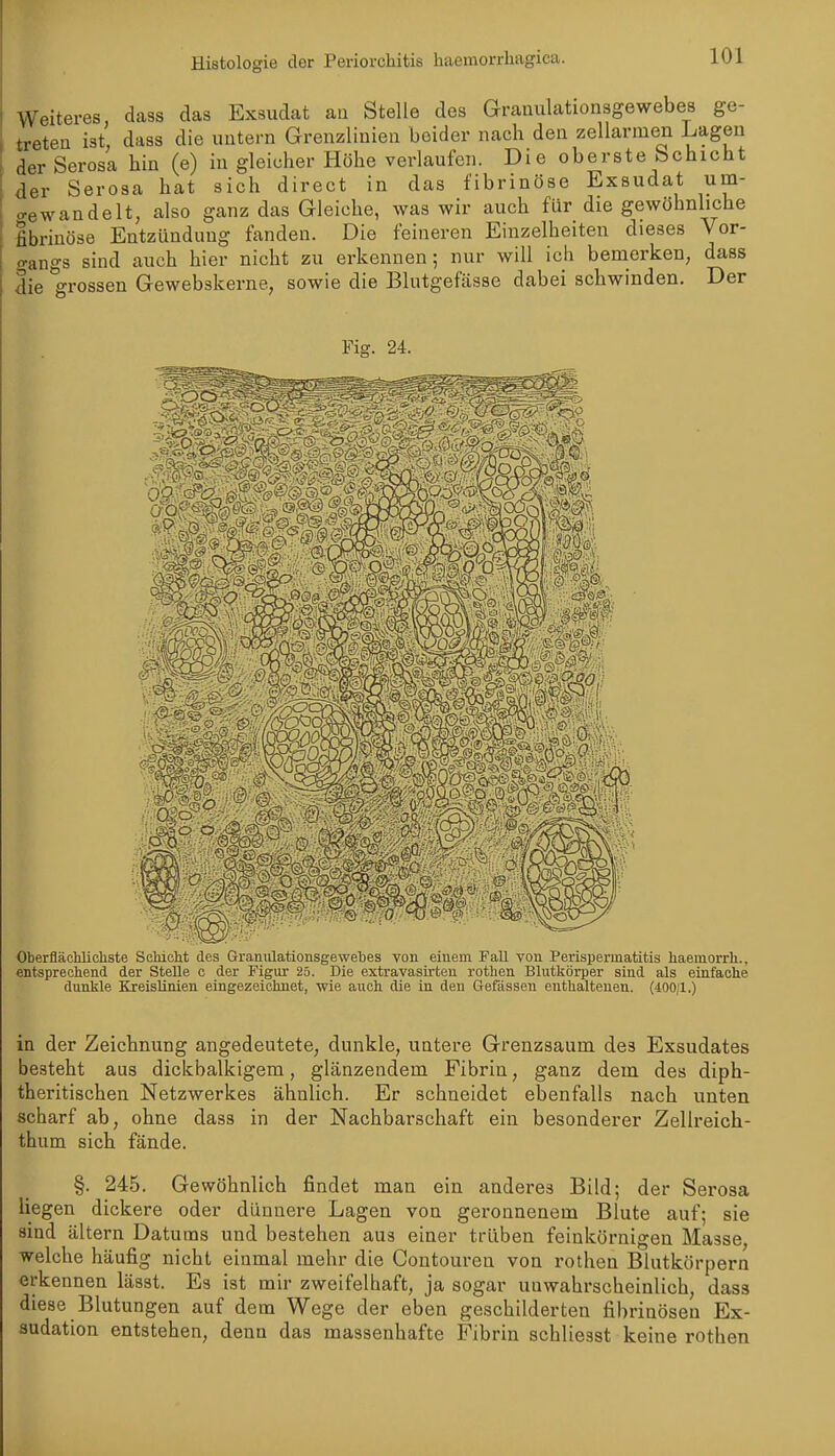 Weiteres, dass das Exsudat au Stelle des Granulationsgewebes ge- treten ist dass die untern Grenzlinien beider nach den zellarmen Lagen der Serosa hin (e) in gleicher Höhe verlaufen. Die oberste Schicht der Serosa hat sich direct in das fibrinöse Exsudat um- o-ewandelt, also ganz das Gleiche, was wir auch für die gewöhnliche fibrinöse Entzündung fanden. Die feineren Einzelheiten dieses Vor- gangs sind auch hier nicht zu erkennen; nur will ich bemerken, dass die grossen Gewebskerne, sowie die Blutgefässe dabei schwinden. Der Fig. 24. Oberflächlicliste Schicht des Graniüationsgewehes von eiuem Fall von Perisperinatitis haeinorrh., entsprechend der Stelle c der Figur 25. Die extravasirten rothen Blutkörper sind als einfache dunkle Kreislinien eingezeichnet, wie auch die in den Gefässen enthaltenen. (400;l.) in der Zeichnung angedeutete, dunkle, untere Grenzsaum des Exsudates besteht aus dickbalkigem, glänzendem Fibrin, ganz dem des diph- theritischen Netzwerkes ähnlich. Er schneidet ebenfalls nach unten scharf ab, ohne dass in der Nachbarschaft ein besonderer Zellreich- thum sich fände. §. 245. Gewöhnlich findet man ein anderes Bild; der Serosa liegen dickere oder dünnere Lagen von geronnenem Blute auf; sie sind ältern Datums und bestehen aus einer trüben feinkörnigen Masse, welche häufig nicht einmal mehr die Contouren von rothen Blutkörpern erkennen lässt. Es ist mir zweifelhaft, ja sogar unwahrscheinlich, dass diese Blutungen auf dem Wege der eben geschilderten fibrinösen Ex- sudation entstehen, denn das massenhafte Fibrin schliesst keine rothen