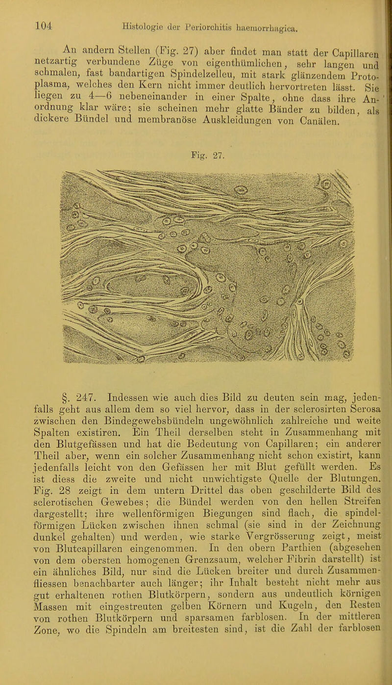 An andern Stellen (Fig. 27) aber findet man statt der Capillaren netzartig verbundene Züge von cigenthümlichen, sehr langen und schmalen, fast bandartigen Spindelzelleu, mit stark glänzendem Proto- plasma, welches den Kern nicht immer deutlich hervortreten lässt. Sie liegen zu 4—G nebeneinander in einer Spalte, ohne dass ihre An- ordnung klar Wcäre; sie scheinen mehr glatte Bänder zu bilden, als dickere Bündel und membranöse Auskleidungen von Canälen. ' Fig. 27. §. 247. Indessen wie auch dies Bild zu deuten sein mag, jeden- falls geht aus allem dem so viel hervor, dass in der sclerosirten Serosa zwischen den Bindegewebsbündeln ungewöhnlich zahlreiche und weite Spalten existiren. Ein Theil derselben steht in Zusammenhang mit den Blutgefässen und hat die Bedeutung von Capillaren; ein anderer Theil aber, wenn ein solcher Zusammenhang nicht schon existirt, kann jedenfalls leicht von den Gefässen her mit Blut gefüllt werden. Es ist diess die zweite und nicht unwichtigste Quelle der Blutungen. Fig. 28 zeigt in dem untern Drittel das oben geschilderte Bild des sclerotischen Gewebes; die Bündel werden von den hellen Streifen dargestellt; ihre wellenförmigen Biegungen sind flach, die spindel- förmigen Lücken zwischen ihnen schmal (sie sind in der Zeichnung dunkel gehalten) und werden, wie starke Vergrösserung zeigt, meist von Blutcapillaren eingenommen. In den obern Parthien (abgesehen von dem obersten homogenen Grenzsaum, welcher Fibrin darstellt) ist ein ähnliches Bild, nur sind die Lücken breiter und durch Zusammen- fliessen benachbarter auch länger; ihr Inhalt besteht nicht mehr aus gut erhaltenen rothen Blutkörpern, sondern aus undeutlich körnigen Massen mit eingestreuten gelben Körnern und Kugeln, den Resten von rothen Blutkörpern und sparsamen farblosen. In der mittleren Zone, wo die Spindeln am breitesten sind, ist die Zahl der farblosen