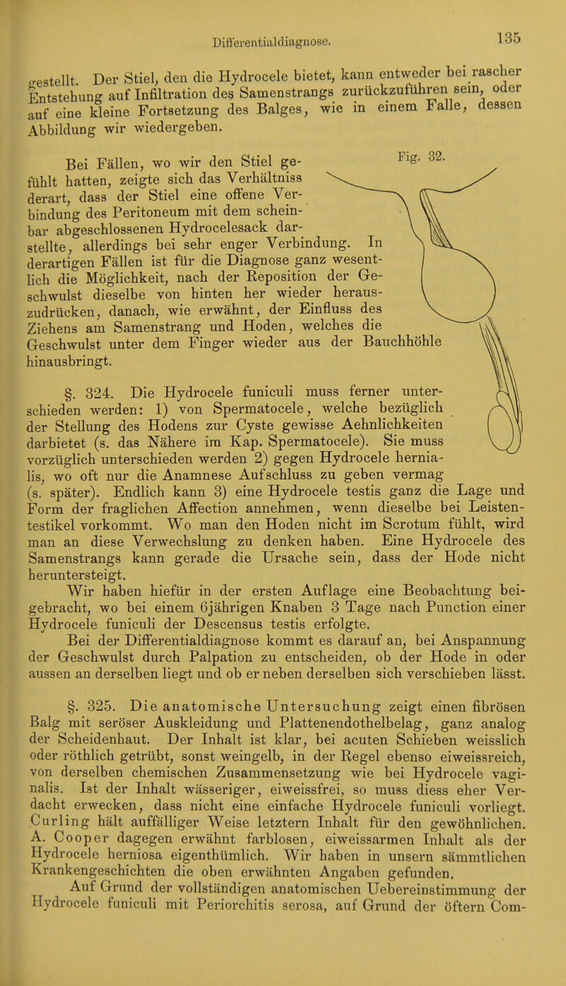 DifterentialcUagnose. crestellt Der Stiel, den die Hydrocele bietet, kann entweder bei rascher Entstehung auf Infiltration de^ Samenstrangs zurückzuführen sem oder auf eine kleine Fortsetzung des Balges, wie m einem ialle, dessen Abbildung wir wiedergeben. Bei Fällen, wo wir den Stiel ge- fühlt hatten, zeigte sich das Verhältniss derart, dass der Stiel eine offene Ver- bindung des Peritoneum mit dem schein- bar abgeschlossenen Hydrocelesack dar- stellte, allerdings bei sehr enger Verbindung. In derartigen Fällen ist für die Diagnose ganz wesent- lich die Möglichkeit, nach der Reposition der Ge- schwulst dieselbe von hinten her wieder heraus- zudrücken, danach, wie erwähnt, der Einfluss des Ziehens am Samenstrang und Hoden, welches die Geschwulst unter dem Finger wieder aus der Bauchhöhle hinausbringt. §. 324. Die Hydrocele funiculi muss ferner unter- schieden werden: 1) von Spermatocele, welche bezüglich der Stellung des Hodens zur Cyste gewisse Aehnlichkeiten darbietet (s. das Nähere im Kap. Spermatocele). Sie muss vorzüglich unterschieden werden 2) gegen Hydrocele hernia- lis, wo oft nur die Anamnese Aufschluss zu geben vermag (s. später). Endlich kann 3) eine Hydrocele testis ganz die Lage und Form der fraglichen Affection annehmen, wenn dieselbe bei Leisten- testikel vorkommt. Wo man den Hoden nicht im Scrotum fühlt, wird man an diese Verwechslung zu denken haben. Eine Hydrocele des Samenstrangs kann gerade die Ursache sein, dass der Hode nicht heruntersteigt. Wir haben hiefür in der ersten Auflage eine Beobachtung bei- gebracht, wo bei einem 6jährigen Knaben 3 Tage nach Function einer Hydrocele funiculi der Descensus testis erfolgte. Bei der Differentialdiagnose kommt es darauf an, bei Anspannung der Geschwulst durch Palpation zu entscheiden, ob der Hode in oder aussen an derselben liegt und ob er neben derselben sich verschieben lässt. §. 325. Die anatomische Untersuchung zeigt einen fibrösen Balg mit seröser Auskleidung und Plattenendothelbelag, ganz analog der Scheidenhaut. Der Inhalt ist klar, bei acuten Schieben weisslich oder röthlich getrübt, sonst weingelb, in der Regel ebenso eiweissreich, von derselben chemischen Zusammensetzung wie bei Hydrocele vagi- nalis. Ist der Inhalt wässeriger, eiweissfrei, so muss diess eher Ver- dacht erwecken, dass nicht eine einfache Hydrocele funiculi vorliegt. Curl ing hält auffälHger Weise letztern Inhalt für den gewöhnlichen. A. Cooper dagegen erwähnt farblosen, eiweissarmen Inhalt als der Hydrocele herniosa eigenthümlich. Wir haben in unsern sämmtlichen Krankengeschichten die oben erwähnten Angaben gefunden. Auf Grund der vollständigen anatomischen Uebereinstimmung der Hydrocele funiculi mit Periorchitis serosa, auf Grund der öftern Com-