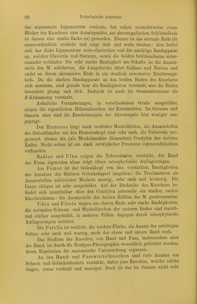 das sogenannte Ligamentum conicum, hat schon normalerweise einen Höcker des Knochens zum Ansatzpunkte, am akromegaUschen Schlüsselbein ist daraus eine starke Zacke (a) geworden. Ebenso ist das sternale Ende (b) ausserordentlich verdickt und zeigt tiefe und weite Gruben: hier heftet sich das dicke Ligamentum costo-claviculare und der mächtige Bandapparat an, welcher Clavicula und Sternum, sowie die beiden Schlüsselbeine unter- einander verbindet. Die sehr starke Rauhigkeit am Schafte ist die Ansatz- stelle des M. subclavius, die Längsfurche fühi't Gefässe und Nerven und endet an ihrem akromialen Ende in ein deutUeh erweitertes Ernährungs- loch. Da die starken Bandapparate an den beiden Enden des Knochens sich ansetzen, sind gerade hier die Eauhigkeiten verstärkt, also die Enden besonders plump und dick. Dadurch ist auch im Gesammtcontom* die A^-Krümmung verstärkt. Aehnliche Veränderungen, in verschiedenem Grade ausgebildet, zeigen die eigentlichen Röhrenknochen der Extremitäten. Im Grossen und Ganzen aber sind die Erscheinungen der Akromegalie hier weniger aus- geprägt. Der Humerus trägt stark verdickte Muskelleisten, die Ansatzstellen der Gelenkbänder um den Humeruskopf sind sehr rauh, die Tubercula ver- grössert, ebenso die (als Muskelansätze dienenden) Oondylen des unteren Endes. Nicht selten ist ein stark entwickelter Processus supraeondyloideus vorhanden. Radius und ülna zeigen die Tuberositates verstärkt, der Rand der Fossa sigmoidea ulnae trägt öfters osteophytische Auflagerungen. Am Femur ist der Gelenkkopf von den verstärkten Rauhigkeiten des Ansatzes der fibrösen Gelenkskapsel umgeben; die Trochanteren als Ansatzstellen zahlreicher Muskeln massig, sehr rauh und höckerig. Die Linea obliqua ist sehr ausgebildet. Auf der Rückseite des Knochens be- findet sich unmittelbar über den Condylen jederseits ein starker, rauher Knochenkamm: die Ansatzstelle der beiden Hälften des M. gastroenemius. Tibia und Fibula tragen am oberen Ende sehr starke Rauhigkeiten, die normalen Sehnen- und Muskelfurchen der unteren Enden sind manch- mal stärker ausgehöhlt, in anderen Fällen dagegen durch osteophytische Auflagerungen seichter. Die Patella ist verdickt, die vordere Fläche, als Ansatz der mächtigen Sehne, sehr rauh und warzig, auch der obere und untere Rand rauh. Das Studium der Knochen von Hand und Fuss, insbesondere aber der Hand, ist durch die Röntgen-Photographie wesentlich gefördert worden, deren Ergebnisse die anatomische Untersuchung ergänzen. An den Hand- und Fusswurzelknochen sind viele Ansätze von Sehnen und Gelenksbändern verstärkt, daher jene Knochen, welche solche tragen, etwas verdickt und massiger. Doch ist das im Ganzen nicht sehr