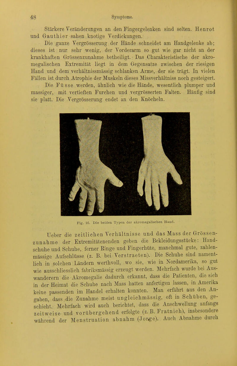 Stärkere Veränderungen an den Fingergelenken sind selten. Henrot und Gauthier sahen knotige Verdickungen. Die ganze Vergrösserung der Hände schneidet am Handgelenke ab; dieses ist nur sehr wenig, der Vorderarm so gut wie gar nicht an der krankhaften Grössenzunahme betheiligt. Das Charakteristische der akro- megalischen Extremität liegt in dem Gegensatze zwischen der riesigen Hand und dem verhältnissmässig schlanken Arme, der sie trägt. In vielen Fällen ist durch Atrophie der Muskeln dieses Missverhältniss noch gesteigert. Die Füsse werden, ähnhch wie die Hände, wesentlich plumper und massiger, mit vertieften Furchen und vergrösserten Falten. Häufig sind sie platt. Die Vergrösserung endet an den Knöcheln. Fig. IG. Die beiden Typen der altromegalischen Hand. Ueber die zeitlichen Verhältnisse und das Mass der Grössen- zunahme der Extremitätenenden geben die Bekleidungsstücke: Hand- schuhe und Schuhe, ferner Einge und Fingerhüte, manchmal gute, zahlen- mässige Aufschlüsse (z. B. bei Verstraeten). Die Schuhe sind nament- lich in solchen Ländern werthvoll, wo sie, wie in Nordamerika, so gut wie ausschliesslich fabriksmässig erzeugt werden. Mehrfach wurde bei Aus- wanderern die Akromegalie dadurch erkannt, dass die Patienten, die sich in der Heimat die Schuhe nach Mass hatten anfertigen lassen, in Amerika keine passenden im Handel erhalten konnten. Man erfährt aus den An- gaben, dass die Zunahme meist ungleichmässig, oft in Schüben, ge- schieht Mehrfach wird auch berichtet, dass die Anschwellung anfangs zeitweise und vorübergehend erfolgte (z.B. Fratnich), msbesondere während der Menstruation abnahm (Jor^-e). Auch Abnahme durch