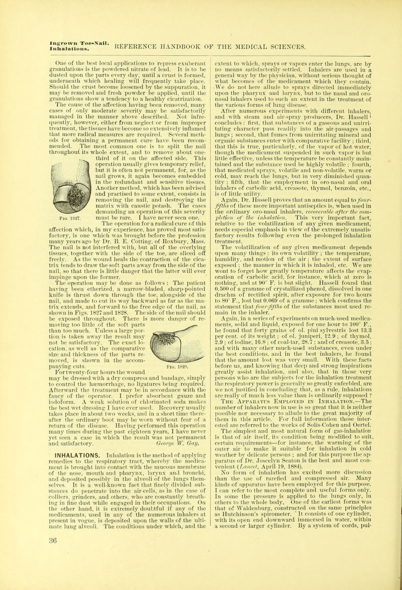 Ingrown Toe-IVail. Inhalations. REFERENCE HANDBOOK OF THE MEDICAL SCIENCES. One of the best local applications to repress exuberant granulations is the powdered nitrate of lead. It is to be dusted upon the parts every day, until a crust is formed, underneath which healing will frequently take place. Should the crust become loosened by the suppuration, it may be removed and fresh powder be applied, until the granulations show a tendency to a healthy cicatrization. The cause of the affection having been removed, many cases of only moderate severity may be satisfactorily managed in the manner above described. Not infre- quently, however, either from neglect or from improper treatment, the tissues have become so extensively inflamed that more radical measures are required. Several meth- ods for obtaining a permanent cure have been recom- mended. The most common one is to split the nail throughout its whole extent, and to remove about one- third of it on the affected side. This operation usually gives temporary relief, but it is often not permanent, for, as the nail grows, it again becomes embedded in the redundant and sensitive tissues. Another method, which has been advised and practised to some extent, consists in removing the nail, and destroying the matrix with caustic potash. The cases demanding an operation of this severity Fig. 1S27. must be rare. I have never seen one. The operation for a radical cure of this affection which, in my experience, has proved most satis- factory, is one which was brought before the profession many years ago by Dr. B. E. Cotting, of Roxbury, Mass. The nail is not interfered with, but all of the overlying tissues, together with the side of the toe, are sliced off freely. As the wound heals the contraction of the cica- trix tends to draw the soft parts away from the side of the nail, so that there is little danger that the latter will ever impinge upon the former. The operation may be done as follows : The patient having been etherized, a narrow-bladed, sharp-pointed knife is thrust down through the toe, alongside of the nail, and made to cut its way backward as far as the ma- trix extends, and forward to the free edge of the nail, as shown in Figs. 1827 and 1828. The side of the nail should be exposed throughout. There is more danger of re- moving too little of the soft parts than too much. Unless a large por- tion is taken away the result may not be satisfactory. The exact lo- cation, as well as the comparative size and thickness of the parts re- moved, is shown in the accom- panying cuts. For twenty-four hours the wound may be dressed with a dry compress and bandage, simply to control the haemorrhage, no ligatures being required. Afterward the treatment may be in accordance with the fancy of the operator. I prefer absorbent gauze and iodoform. A weak solution of chlorinated soda makes the best wet dressing I have ever used. Recovery usually takes place in about two weeks, and in a short time there- after the ordinary boot may be worn without fear of a return of the disease. Having performed this operation many times during the past eighteen years, I have never yet seen a case in which the result was not permanent and satisfactory. George W. Gay. INHALATIONS. Inhalation is the method of applying remedies to the respiratory tract, whereby the medica- ment is brought into contact with the mucous membrane of the nose, mouth and pharynx, larynx and bronchi, and deposited possibly in the alveoli of the lungs them- selves. It is a well-known fact that finely divided sub- stances do penetrate into the air-cells, as in the case of colliers, grinders, and others, who are constantly breath- ing in fine dust while engaged in their occupations. On the other hand, it is extremely doubtful if any of the medicaments, used in any of the numerous inhalers at present in vogue, is deposited upon the walls of the ulti- mate lung alveoli. The conditions under which, and the Fig. 182S. extent to which, sprays or vapors enter the lungs, are by no means satisfactorily settled. Inhalers are used in a general way by the physician, without serious thought of what becomes of the medicament which they contain. We do not here allude to sprays directed immediately upon the pharynx and larynx, but to the nasal and oro- nasal inhalers used to such an extent in the treatment of the various forms of lung disease. After numerous experiments with different inhalers, and with steam and air-spray producers, Dr. Hassell1 concludes : first, that substances of a gaseous and unirri- tating character pass readily into the air-passages and lungs ; second, that fumes from unirritating mineral and organic substances enter with comparative facility ; third, that this is true, particularly, of the vapor of hot water, though the medicament suspended in such vapor is but little effective, unless the temperature be constantly main- tained and the substance used be highly volatile ; fourth, that medicated sprays, volatile and non-volatile, warm or cold, may reach the lungs, but in very diminished quan- tity ; fifth, that the employment in oro-nasal and oral inhalers of carbolic acid, creasote, thymol, benzoin, etc., is of little utility. Again, Dr. Hassell proves that an amount equal to fonr- ffths of these more important antiseptics is, when used in the ordinary oro-nasal inhalers, recoverable after the com- pletion of the inhalation. This very important fact, relative to the volatilization of any given medicament, needs especial emphasis in view of the extremely unsatis- factory results following even the prolonged inhalation treatment. The volatilization of any given medicament depends upon man}' things : its own volatility ; the temperature, humidity, and motion of the air ; the extent of surface exposed ; the manner in which it is inhaled, etc. We are wont to forget how greatly temperature affects the evap- oration of carbolic acid, for instance, which at zero is nothing, and at 90° F. is but slight. Hassell found that 0.500 of a gramme of crystallized phenol, dissolved in one drachm of rectified spirit, after exposure for two hours to 80° F., lost but 0.069 of a gramme ; which confirms the statement that four-fifths of the substances most used re- main in the inhaler. Again, in a series of experiments on much-used medica- ments, solid and liquid, exposed for one hour to 100° F., he found that forty grains of ol. pini sylvestris lost 13.3 per cent, of its weight ; of ol. juniperi, 12.9 ; of thymol, 2.9 ; of iodine, 16.8 ; of coal-tar, 28.7 ; and of creasote, 3.5 ; and with many other much-used substances, even under the best conditions, and in the best inhalers, he found that the amount lost was very small. With these facts before us, and knowing that deep and strong inspirations greatly assist inhalation, and also, that in those very persons who are the subjects for the inhalation treatment the respiratory power is generally so greatly enfeebled, are we not justified in concluding that, as a rule, inhalations are really of much less value than is ordinarily supposed ? The Apparatus Employed in Inhalation.—The number of inhalers now in use is so great that it is neither possible nor necessary to allude to the great majority of them in this article. For full information those inter- ested are referred to the works of Solis-Cohen and Oertel. The simplest and most natural form of gas-inhalation is that of air itself, its condition being modified to suit, certain requirements—for instance, the warming of the outer air to make it suitable for inhalation in cold weather by delicate persons ; and for this purpose the ap- paratus of Dr. Joscelyn Seaton is the best and most con- venient (Lancet, April 19, 1884). No form of inhalation has excited more discussion than the use of rarefied and compressed air. Many kinds of apparatus have been employed for this pui-pose. I can refer to the most complete and useful forms only. In some the pressure is applied to the lungs only, in others to the whole body. One of the earliest forms was that of Waldenburg, constructed on the same principles as Hutchinson's spirometer. ' It consists of one cylinder, with its open end downward immersed in water, within a second or larger cylinder. By a system of cords, pul-