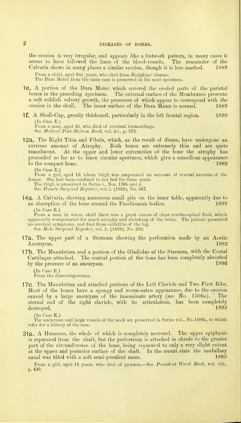 the erosion is very irregular, and appears like a fretwork pattern, in many cases it seems to have followed the lines of the blood-vessels. The remainder of the Calvaria shows in many places a similar erosion, though it is less marked. 1889 From a child, aged five years, wlio died from Hodgkins' disease. The Dura Mater from the same case is preserved in the next specimen. 1e. A portion of the Dura Mater which covered the eroded parts of the parietal bones in the preceding specimen. The external surface of the Membranes presents a soft reddish velvety growth, the processes of which appear to correspond with the erosion in the skull. The inner surface of the Dura Mater is normal. 1889 If. A Skull-Cap, greatly thickened, particularly in the left frontal region. 1890 (In Case E.) From a man, aged 45, who died, of cerebral hsemorrhage. See Medical Pust-3Iurtem Book, vol. xv,, p. 373. 12a. The Right Tibia and Fibula, which, as the result of disuse, have undergone an extreme amount of Atrojjhy. Both bones are extremely thin and are quite translucent. At the upper and lower extremities of the bone the atrophy has proceeded so far as to leave circular apertures, which give a cancellous appearance to the compact bone. 1889 (In Case E.) From a girl, aged 13, whose tliigh was amputated on account of central necrosis of the femur. She had been confined to her bed for three years. The thigh is preserved in Series i., Nos. I38b and c. See Female Surgical Register, vol. i. (1889), No. 367. 14a. A Calvaria, showing numerous small pits on the inner table, apparently due to an absorption of the bone around the Pacchionian bodies. 1889 (In Case E.) From a man in whose skull there was a great excess of clear cerebro-spinal fluid, which apparently compensated for much atrophy and shrinking of the brain. The patient presented no cerebral symptoms, and died from cellulitis of the leg. See Male Surgical liegister, vol. ii. (1889), No. 210. 17a. The upper part of a Sternum showing the perforation made by an Aortic Aneurysm. 1882 17b. The Manubrium and a portion of the Gladiolus of the Sternum, with the Costal Cartilages attached. The central portion of the bone has been completely absorbed by the pressure of an aneurysm. 1886 (In Case E.) From the dissecting-rooms. 17c, The Manubrium and attached portions of tlie Left Clavicle and Two First Eibs. Most of the bones have a spongy and worm-eaten appearance, due to the erosion caused by a large aneurysm of the innominate artery (see No. 1506a). Tlie sternal end of the right clavicle, with its articulation, has been completely destroyed. 1893 (In Case E,) The aneurysm and large vessels of the neck are preserved in Series viii., No. 1506a, to which refer for a history of the case. 31a. A Humerus, the whole of which is completely necrosed. The upper epiphysis is separated from the shaft, but the periosteum is attached in shreds to the greater part of the circumference of the bone, being separated to only a very slight extent at the upper and posterior surface of the shaft. In the recent state the medullary canal was filled with a soft semi-purulent mass. 1883 From a girl, aged 14 years, who died of pyaemia.—See President Ward Booh, vol. viii., p. 430.