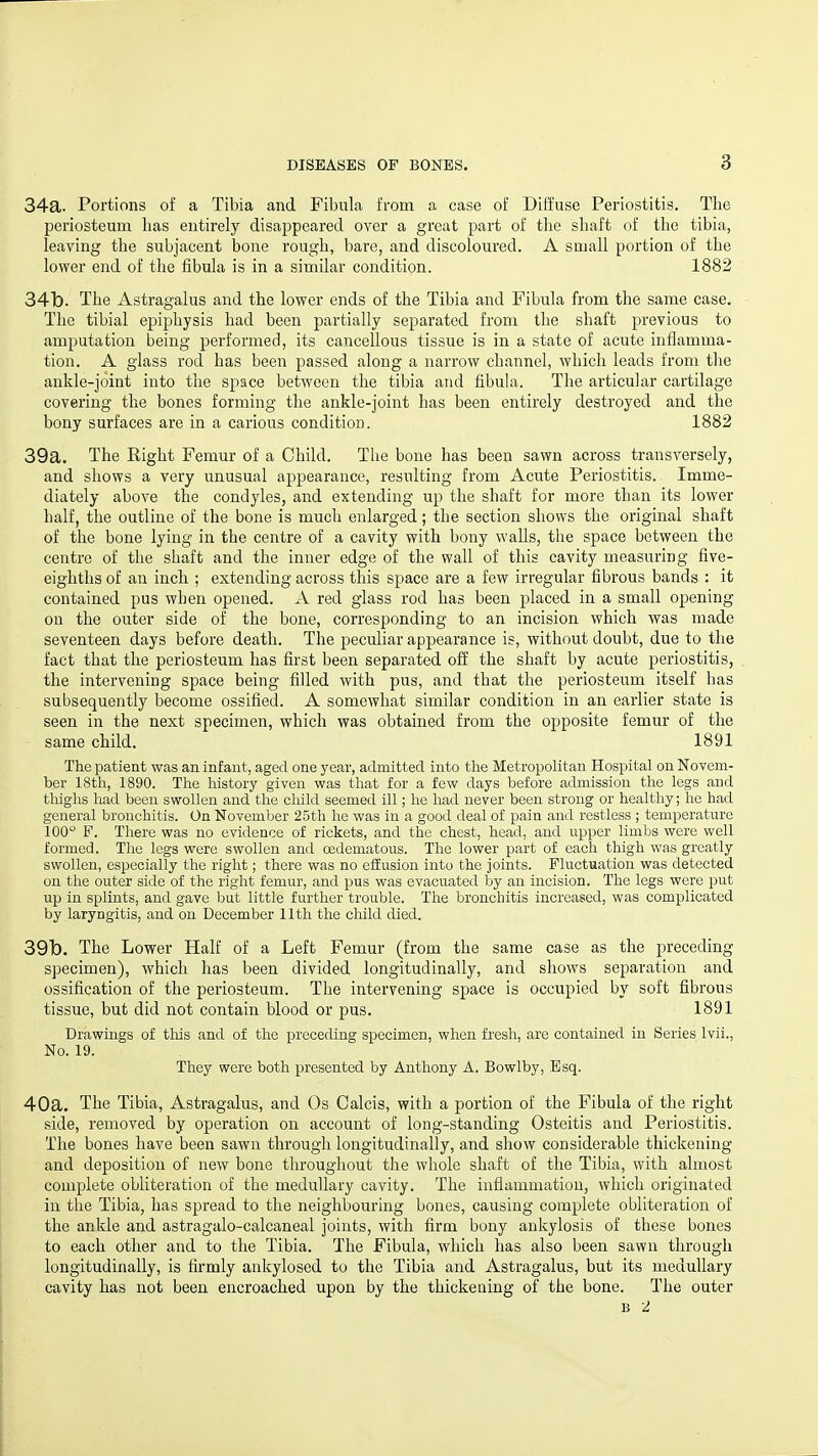 34a. Portions of a Tibia and Fibula from a case of Diffuse Periostitis. The periosteum has entirely disappeared over a great part of the shaft of the tibia, leaving the subjacent bone rough, bare, and discoloured. A small portion of the lower end of the fibula is in a similar condition. 1882 34b. The Astragalus and the lower ends of the Tibia and Fibula from the same case. The tibial epijohysis had been partially separated from the shaft previous to amputation being performed, its cancellous tissue is in a state of acute inflamma- tion. A glass rod has been passed along a narrow channel, which leads from the ankle-joint into the space between the tibia and fibula. The articular cartilage covering the bones forming the ankle-joint has been entirely destroyed and the bony surfaces are in a carious condition. 1882 39a. The Eight Femur of a Child. The bone has been sawn across transversely, and shows a very unusual appearance, resulting from Acute Periostitis. Imme- diately above the condyles, and extending up the shaft for more than its lower half, the outline of the bone is much enlarged; the section shows the original shaft of the bone lying in the centre of a cavity with bony walls, the space between the centre of the shaft and the inner edge of the wall of this cavity measuring five- eighths of an inch ; extending across this space are a few irregular fibrous bands : it contained pus when opened. xV red glass rod has been placed in a small opening on the outer side of the bone, corresponding to an incision which was made seventeen days before death. The peculiar appearance is, without doubt, due to the fact that the periosteum has first been separated off the shaft by acute periostitis, the intervening space being filled with pus, and that the periosteum itself has subsequently become ossified. A somewhat similar condition in an earlier state is seen in the next specimen, which was obtained from the opposite femur of the same child. 1891 The patient was an infant, aged one year, admitted into the Metropolitan Hospital on Novem- ber 18th, 1890. The history given was that for a few days before admission the legs and thighs had been swollen and the child seemed ill; he had never been strong or healthy; he had general bronchitis. On November 25th he was in a good deal of pain and restless ; temperature 100° P. There was no evidence of rickets, and the chest, head, and upper limbs were well formed. The legs were swollen and oedematous. The lower part of each thigh was greatly swollen, especially the right; there was no effusion into the joints. Fluctuation was detected on the outer side of the right femur, and pus was evacuated by an incision. The legs were put up in splints, and gave but little further trouble. The bronchitis increased, was complicated by laryngitis, and on December 11th the child died. 39b. The Lower Half of a Left Femur (from the same case as the preceding specimen), which has been divided longitudinally, and shows separation and ossification of the periosteum. The intervening space is occupied by soft fibrous tissue, but did not contain blood or pus. 1891 Drawings of this and of the preceding specimen, when fresh, are contained in Series Ivii., No. 19. They were both presented by Anthony A. Bowlby, Esq. 40a. The Tibia, Astragalus, and Os Calcis, with a portion of the Fibula of the right side, removed by operation on account of long-standing Osteitis and Periostitis. The bones have been sawn through longitudinally, and show considerable thickening and deposition of new bone throughout the whole shaft of the Tibia, with almost complete obliteration of the medullary cavity. The inflammation, which originated in the Tibia, has spread to the neighbouring bones, causing complete obliteration of the ankle and astragalo-calcaneal joints, with firm bony ankylosis of these bones to each other and to the Tibia. The Fibula, which has also been sawn through longitudinally, is firmly ankylosed to the Tibia and Astragalus, but its medullary cavity has not been encroached upon by the thickening of the bone. The outer B 2