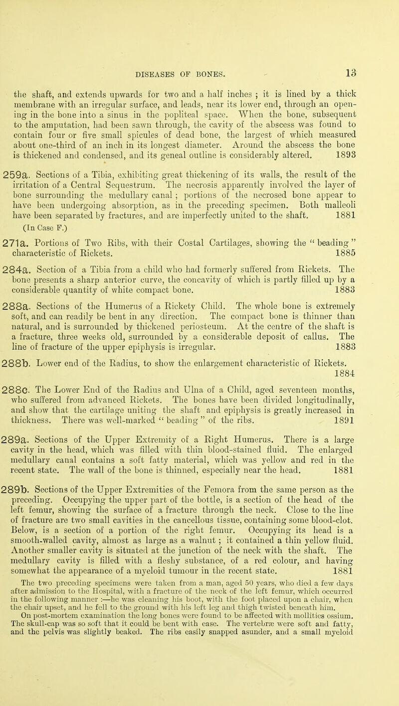 tlie shaft, and extends upwards for two and a half inches ; it is lined by a thick membrane with an irregular surface, and leads, near its lower end, through an open- ing in the bone into a sinus in the popliteal space. When the bone, subsequent to the amputation, had been sawn through, the cavity of the abscess was found to contain four or tiye small spicules of dead bone, the largest of which measured about one-third of an inch in its longest diameter. Around the abscess the bone is thickened and condensed, and its geneal outline is considerably altered. 1893 259a. Sections of a Tibia, exhibiting great thickening of its walls, the result of the irritation of a Central Sequestrum. The necrosis apparently involved the layer of bone surrounding the medullary canal ; portions of the necrosed bone appear to have been undergoing absorption, as in the preceding specimen. Both malleoli have been separated by fractures, and are imperfectly united to the shaft. 1881 (In Case F.) 271a. Portions of Two Ribs, with their Costal Cartilages, showing the beading characteristic of Rickets. 1885 284a. Section of a Tibia from a child who had formerly suffered from Rickets. The bone presents a sharp anterior curve, the concavity of which is partly filled up by a considerable quantity of white compact bone. 1883 288a. Sections of the Humerus of a Rickety Child. The whole bone is extremely soft, and can readily be bent in any direction. The compact bone is thinner than natural, and is surrounded by thickened periosteum. At the centre of the shaft is a fracture, three weeks old, surrounded by a considerable deposit of callus. The hne of fracture of the upper epiphysis is irregular. 1883 2881d. Lower end of the Radius, to show the enlargement characteristic of Rickets. 1884 288c. The Lower End of the Radius and Ulna of a Child, aged seventeen months, who suffered from advanced Rickets. The bones have been divided longitudinally, and show that the cartilage uniting the shaft and epiphysis is greatly increased in thickness. There was weU-maiked beading of the ribs. 1891 289a. Sections of the Upper Extremity of a Right Humerus. There is a large cavity in the head, which was tilled with thin blood-stained fluid. The enlarged medullary canal contains a soft fatty material, which was yellow and red in the recent state. The wall of the bone is thinned, especially near the head. 1881 2891). Sections of the Upper Extremities of the Femora from the same person as the preceding. Occupying the upper part of the bottle, is a section of the head of the left femur, showing the surface of a fracture through the neck. Close to the line of fracture are two small cavities in the cancellous tissue, containing some blood-clot. Below, is a section of a portion of the right femur. Occupying its head is a smooth-walled cavity, almost as large as a walnut ; it contained a thin yellow fluid. Another smaller cavity is situated at the junction of the neck with the shaft. The medullary cavity is filled with a fleshy substance, of a red colour, and having somewhat the appearance of a myeloid tumour in the recent state. 1881 The two preceding specimens were taken from a man, aged 50 years, who died a few days after admission to the Hospital, with a fracture of the neck of the left femur, which occurred in the following manner :—he was cleaning his boot, with the foot placed upon a chair, when the chair upset, and he foil to the ground with his left leg aud thigh twisted beneath him. On post-mortem examination the long bones were found to be affected with mollitics ossium. The skull-cap was so soft that it could be bent with ease. The vertebra3 were soft and fatty, and the pelvis was slightly beaked. The ribs easily snapped asunder, aud a small myeloid