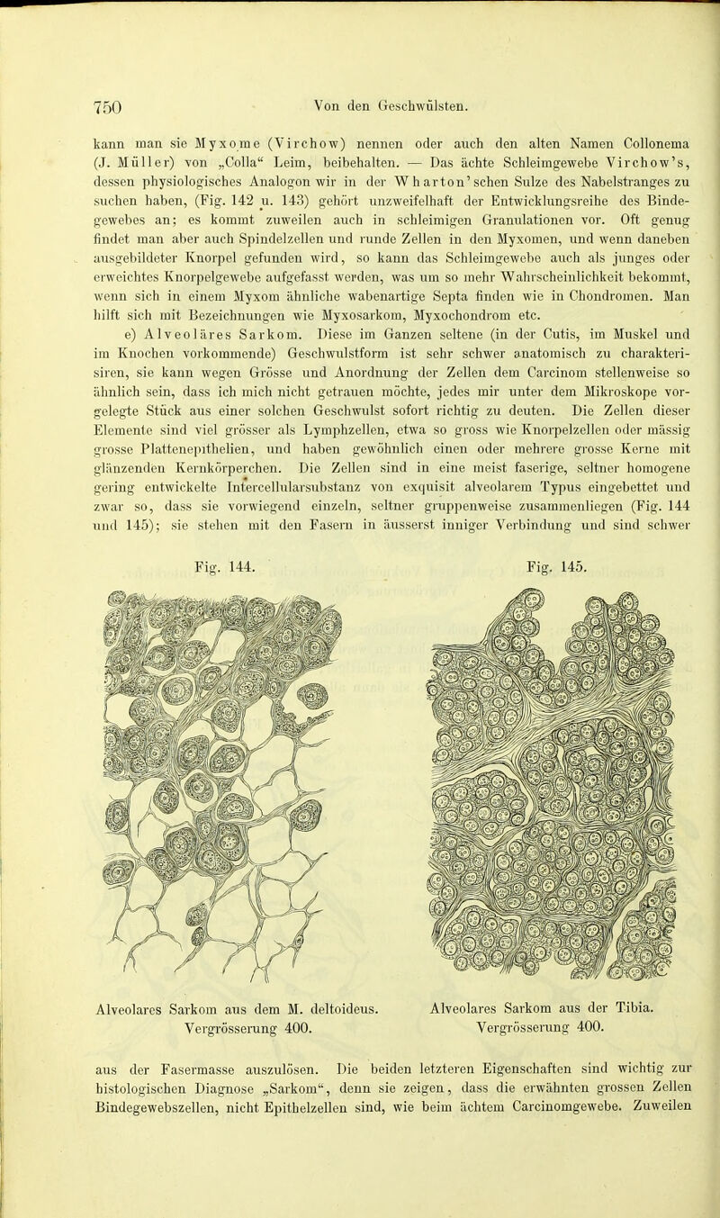 kann man sie Myxome (Virchow) nennen oder auch den alten Namen Collonema (J. Müller) von „Colla Leim, beibehalten. — Das ächte Schleimgewebe Virchow's, dessen physiologisches Analogon wir in der W h arton'sehen Sülze des Nabelstranges zu suchen haben, (Fig. 142 u. 143) gehört unzweifelhaft der Entwicklungsreihe des Binde- gewebes an; es kommt zuweilen auch in schleimigen Granulationen vor. Oft genug rindet man aber auch Spindelzellen und runde Zellen in den Myxomen, und wenn daneben ausgebildeter Knorpel gefunden wird, so kann das Schleimgewebe auch als junges oder erweichtes Knorpelgewebe aufgefasst werden, was um so mehr Wahrscheinlichkeit bekommt, wenn sich in einem Myxom ähnliche wabenartige Septa finden wie in Chondromen. Man hilft sich mit Bezeichnungen wie Myxosarkom, Myxochondrom etc. e) Alveoläres Sarkom. Diese im Ganzen seltene (in der Cutis, im Muskel und im Knochen vorkommende) Geschwulstform ist sehr schwer anatomisch zu charakteri- siren, sie kann wegen Grösse und Anordnung der Zellen dem Carcinom stellenweise so ähnlich sein, dass ich mich nicht getrauen möchte, jedes mir unter dem Mikroskope vor- gelegte Stück aus einer solchen Geschwulst sofort richtig zu deuten. Die Zellen dieser Elemente sind viel grösser als Lymphzellen, etwa so gross wie Knorpelzellen oder mässig grosse Plattenepithelien, und haben gewöhnlich einen oder mehrere grosse Kerne mit glänzenden Kernkörperchen. Die Zellen sind in eine meist faserige, seltner homogene gering entwickelte Intercellularsubstanz von exquisit alveolarem Typus eingebettet und zwar so, dass sie vorwiegend einzeln, seltner gruppenweise zusammenliegen (Fig. 144 und 145); sie stehen mit den Fasern in äusserst inniger Verbindung und sind schwer aus der Fasermasse auszulösen. Die beiden letzteren Eigenschaften sind wichtig zur histologischen Diagnose „Sarkom, denn sie zeigen, dass die erwähnten grossen Zellen Bindegewebszellen, nicht Epithelzellen sind, wie beim ächtem Carcinomgewebe. Zuweilen