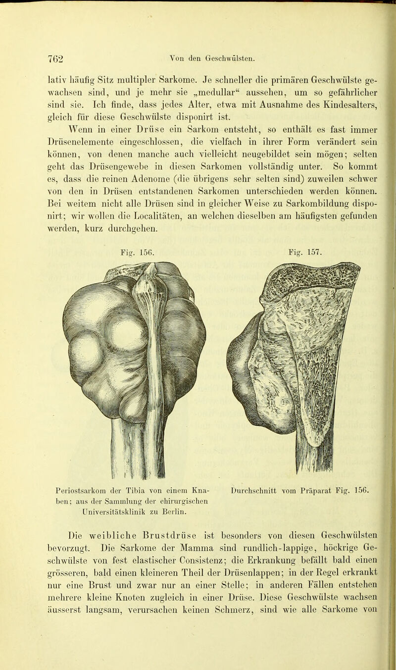 lativ häufig Sitz multipler Sarkome. Je schneller die primären Geschwülste ge- wachsen sind, und je mehr sie „medullär aussehen, um so gefährlicher sind sie. Ich finde, dass jedes Alter, etwa mit Ausnahme des Kindesalters, gleich für diese Geschwülste disponirt ist. Wenn in einer Drüse ein Sarkom entsteht, so enthält es fast immer Drüsenelemente eingeschlossen, die vielfach in ihrer Form verändert sein können, von denen manche auch vielleicht neugebildet sein mögen; selten geht das Drüsengewebe in diesen Sarkomen vollständig unter. So kommt es, dass die reinen Adenome (die übrigens sehr selten sind) zuweilen schwer von den in Drüsen entstandenen Sarkomen unterschieden werden können. Bei weitem nicht alle Drüsen sind in gleicher Weise zu Sarkombildung dispo- nirt; wir wollen die Localitäten, an welchen dieselben am häufigsten gefunden werden, kurz durchgehen. Fig. 156. Fig. 157. Periostsarkom der Tibia von einem Kna- Durchschnitt vom Präparat Fig. 156. ben; aus der Sammlung der chirurgischen Universitätsklinik zu Berlin. Die weibliche Brustdrüse ist besonders von diesen Geschwülsten bevorzugt. Die Sarkome der Mamma sind rundlich-lappige, höckrige Ge- schwülste von fest elastischer Consistenz; die Erkrankung befällt bald einen grösseren, bald einen kleineren Theil der Drüsenlappen; in der Regel erkrankt nur eine Brust und zwar nur an einer Stelle; in anderen Fällen entstehen mehrere kleine Knoten zugleich in einer Drüse. Diese Geschwülste wachsen äusserst langsam, verursachen keinen Schmerz, sind wie alle Sarkome von