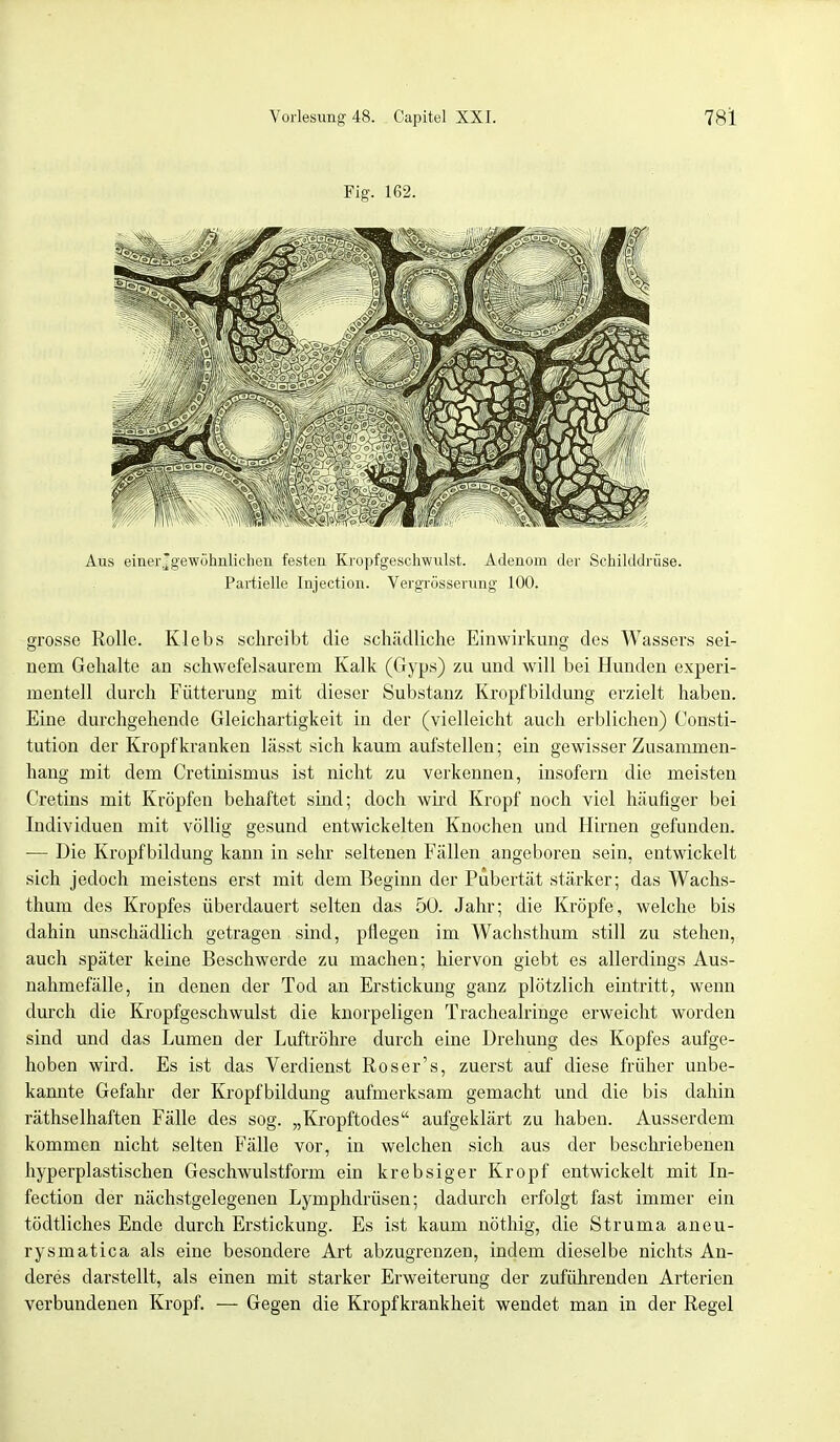 Fig. 162. Aus einerjgewöhnlichen festen Kropfgeschwulst. Adenom der Schilddrüse. Partielle Injection. Vergrößerung 100. grosse Rolle. Klebs schreibt die schädliche Einwirkung des Wassers sei- nem Gehalte an schwefelsaurem Kalk (Gyps) zu und will bei Hunden experi- mentell durch Fütterung mit dieser Substanz Kropfbildung erzielt haben. Eine durchgehende Gleichartigkeit in der (vielleicht auch erblichen) Consti- tution der Kropf kranken lässt sich kaum aufstellen; ein gewisser Zusammen- hang mit dem Cretinismus ist nicht zu verkennen, insofern die meisten Cretins mit Kröpfen behaftet sind; doch wird Kropf noch viel häufiger bei Individuen mit völlig gesund entwickelten Knochen und Hirnen gefunden. — Die Kropfbildung kann in sehr seltenen Fällen angeboren sein, entwickelt sich jedoch meistens erst mit dem Beginn der Pubertät stärker; das Wachs- thum des Kropfes überdauert selten das 50. Jahr; die Kröpfe, welche bis dahin unschädlich getragen sind, pflegen im Wachsthum still zu stehen, auch später keine Beschwerde zu machen; hiervon giebt es allerdings Aus- nahmefälle, in denen der Tod an Erstickung ganz plötzlich eintritt, wenn durch die Kropfgeschwulst die knorpeligen Tracheairinge erweicht worden sind und das Lumen der Luftröhre durch eine Drehung des Kopfes aufge- hoben wird. Es ist das Verdienst Roser's, zuerst auf diese früher unbe- kannte Gefahr der Kropfbildung aufmerksam gemacht und die bis dahin räthselhaften Fälle des sog. „Kropftodes aufgeklärt zu haben. Ausserdem kommen nicht selten Fälle vor, in welchen sich aus der beschriebenen hyperplastischen Geschwulstform ein krebsiger Kropf entwickelt mit In- fection der nächstgelegenen Lymphdrüsen; dadurch erfolgt fast immer ein tödtliches Ende durch Erstickung. Es ist kaum nöthig, die Struma aneu- rysmatica als eine besondere Art abzugrenzen, indem dieselbe nichts An- deres darstellt, als einen mit starker Erweiterung der zuführenden Arterien verbundenen Kropf. — Gegen die Kropfkrankheit wendet man in der Regel