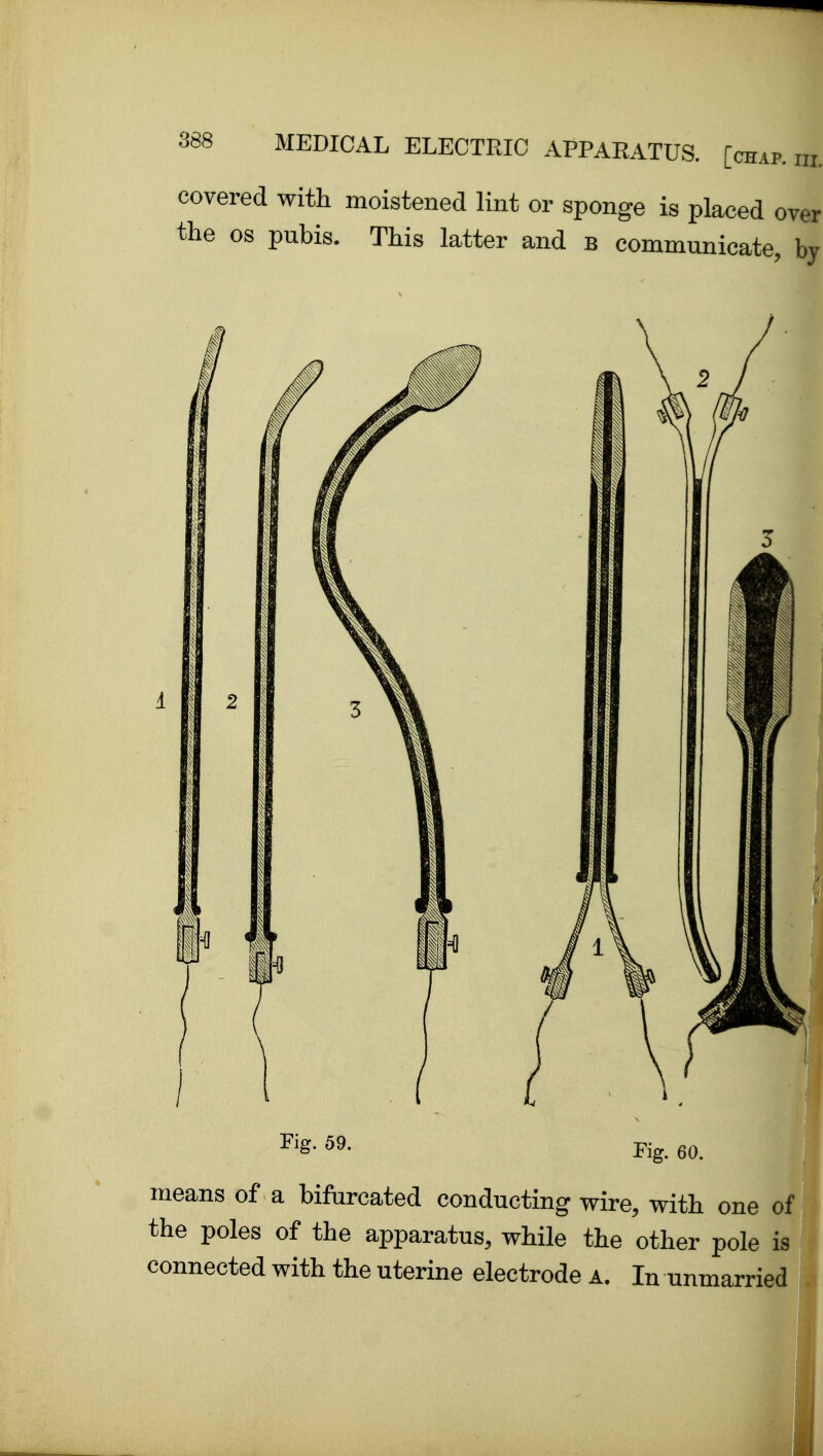 covered with moistened lint or sponge is placed over the OS pubis. This latter and b communicate, by connected with the uterine electrode a. In unmarried