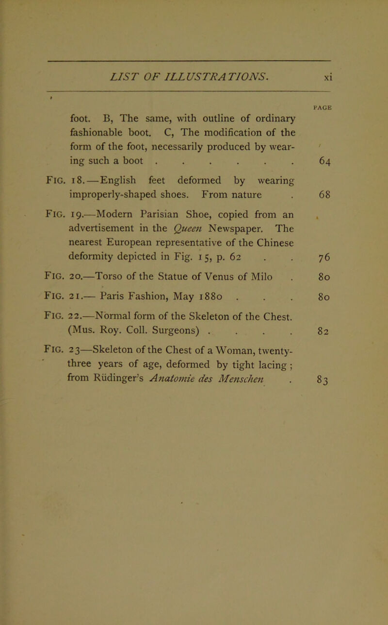 PAGE foot. B, The same, with outline of ordinary fashionable boot. C, The modification of the form of the foot, necessarily produced by wear- ing such a boot ...... 64 Fig. 18.—English feet deformed by wearing improperly-shaped shoes. From nature . 68 Fig. 19.—Modern Parisian Shoe, copied from an advertisement in the Queen Newspaper. The nearest European representative of the Chinese deformity depicted in Fig. 15, p. 62 . . 76 Fig. 20.—Torso of the Statue of Venus of Milo . 80 Fig. 21.— Paris Fashion, May 1880 . . 80 Fig. 22.—Normal form of the Skeleton of the Chest. (Mus. Roy. Coll. Surgeons) . . . . 82 Fig. 23—Skeleton of the Chest of a Woman, twenty- three years of age, deformed by tight lacing ; from Riidinger’s Anatomie des Menschen . 83