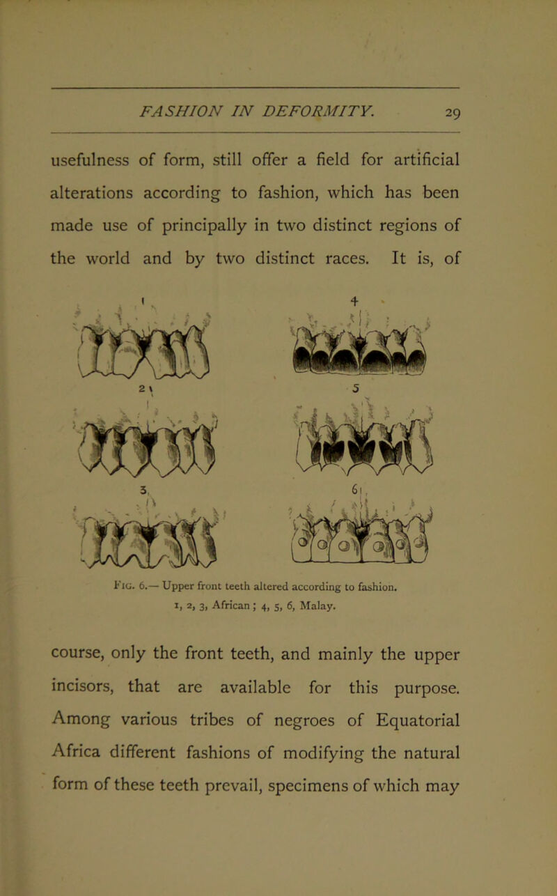 usefulness of form, still offer a field for artificial alterations according to fashion, which has been made use of principally in two distinct regions of the world and by two distinct races. It is, of ' . + 1' IG. 6.— Upper front teeth altered according to fashion. 1, 2, 3> African; 4, 5, 6, Malay. course, only the front teeth, and mainly the upper incisors, that are available for this purpose. Among various tribes of negroes of Equatorial Africa different fashions of modifying the natural form of these teeth prevail, specimens of which may