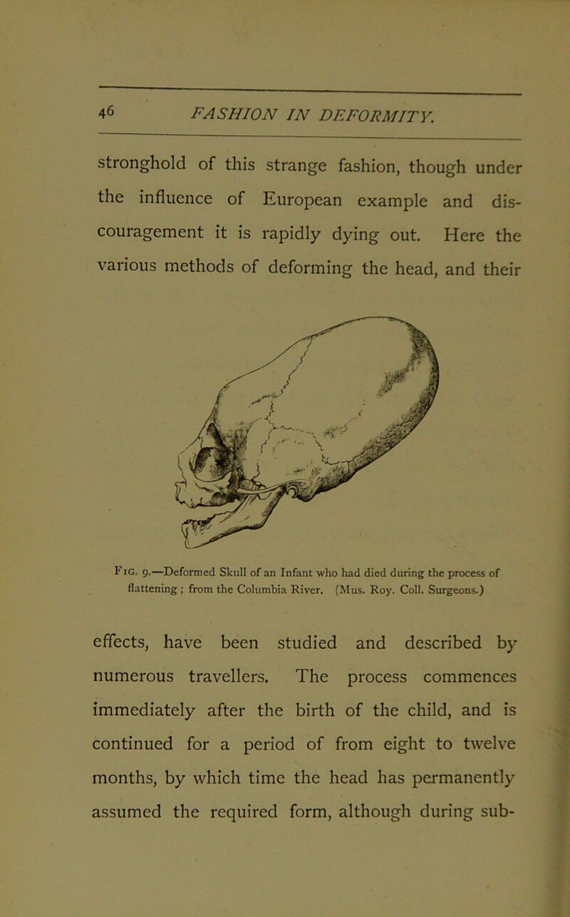 stronghold of this strange fashion, though under the influence of European example and dis- couragement it is rapidly dying out. Here the various methods of deforming the head, and their Fig. 9.—Deformed Skull of an Infant who had died during the process of flattening; from the Columbia River. (Mus. Roy. Coll. Surgeons.) effects, have been studied and described by numerous travellers. The process commences immediately after the birth of the child, and is continued for a period of from eight to twelve months, by which time the head has permanently assumed the required form, although during sub-