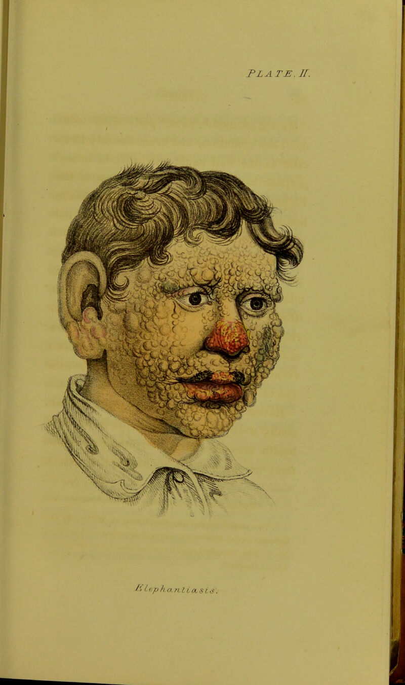 Plate, jr.