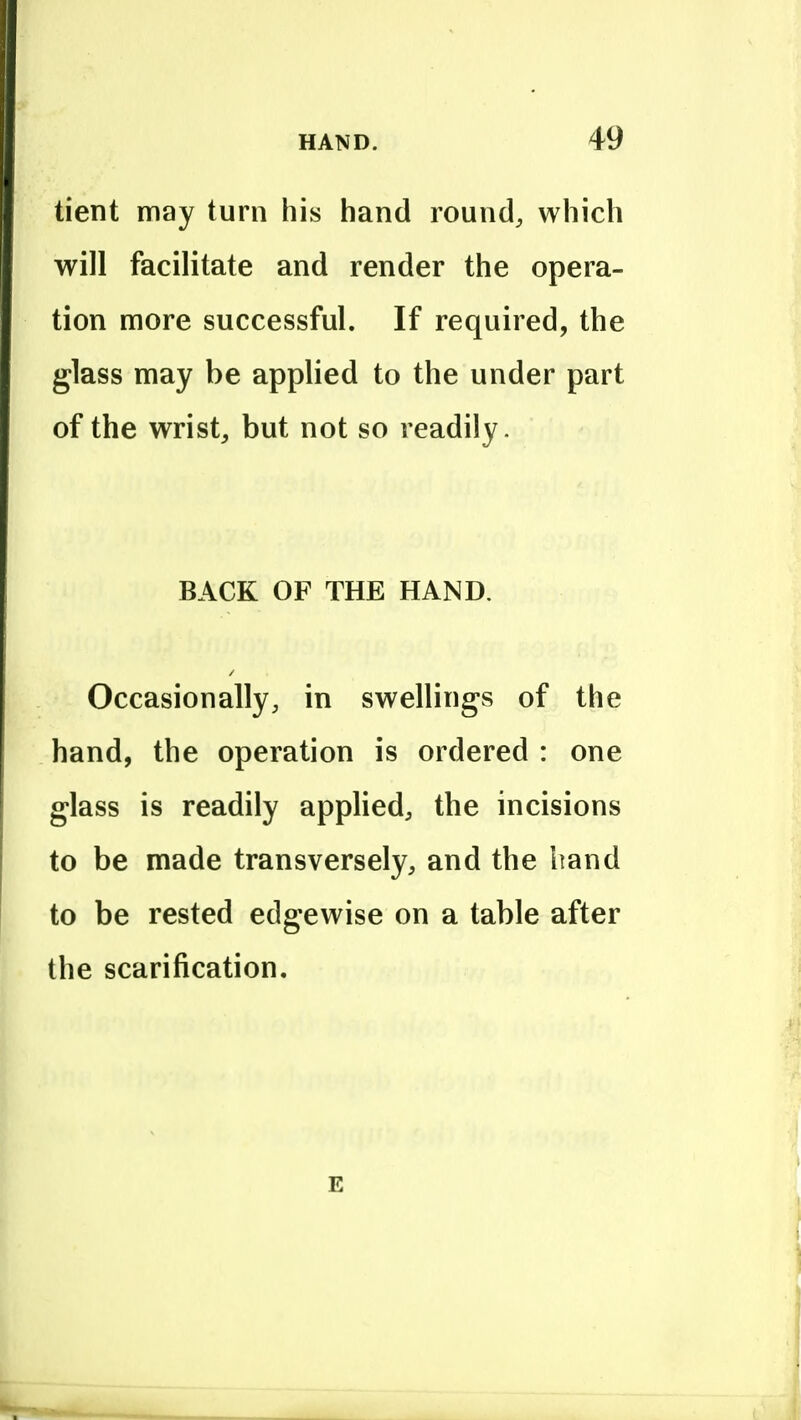 tient may turn his hand round, which will facilitate and render the opera- tion more successful. If required, the glass may be applied to the under part of the wrist^ but not so readily. BACK OF THE HAND. Occasionally, in swellings of the hand, the operation is ordered : one glass is readily applied, the incisions to be made transversely, and the iiand to be rested edgewise on a table after the scarification. E