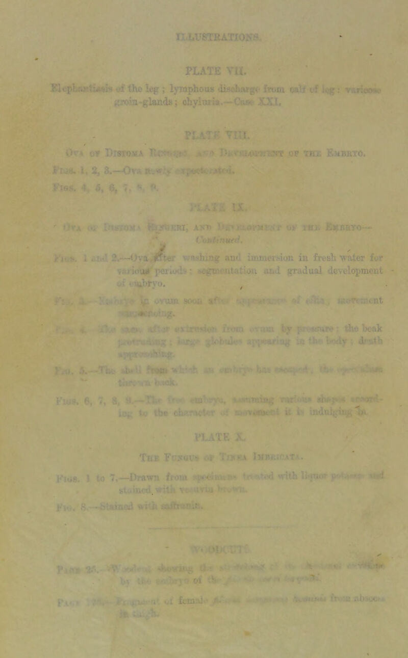 PLATE VII. BUopbnrtw'sl • of the leg ; lymphous disehargt from oali ef . ;*: v/irioo-n- grom-gland*; ohylnrV -CV- XXI, PLATE VlH. i» ' 09 DlffVOMA Hc?t' . ■ . NT OF Til.. jVMBltTO. Flu*. I, 2, 8.—Ovi n « , »w<i. Pi Vi u ' * ■ .l . > ERi; an1’ 1 . .1 . : jin: Lgr.nYO - Vow&inwd. . < ? -Ova |fter • hi^v an' immersion in freshwater fur iottrf' pern.«' . • v- ' utatiuu an l trradual development nuhryo. , .p e\um sow- »*' 1 w«* acnt ■ . ‘i 1 iv d Uh mpptvrKihn.. \ o, 4.--Tot *t»U frMOJ whiofc .« eaV U* tth> r «b Fi«». 6, 7, 8, —TL« ire* etn ryu, 'uunrming tjw'.om shitp- 4 *f>orl* iOj t the che-uUr t vom« it > mdttydv. 'a PLATE X The F; xat> >r Tiwra Iurricat . }‘*1U8. I to 7.—Drawn from od with li*pK» p •* ' id '•* j.i, •* a m iv . htve Flu. 8.—teUinod with saflran.i. u o - oi v •it <jl femajv f : at a: