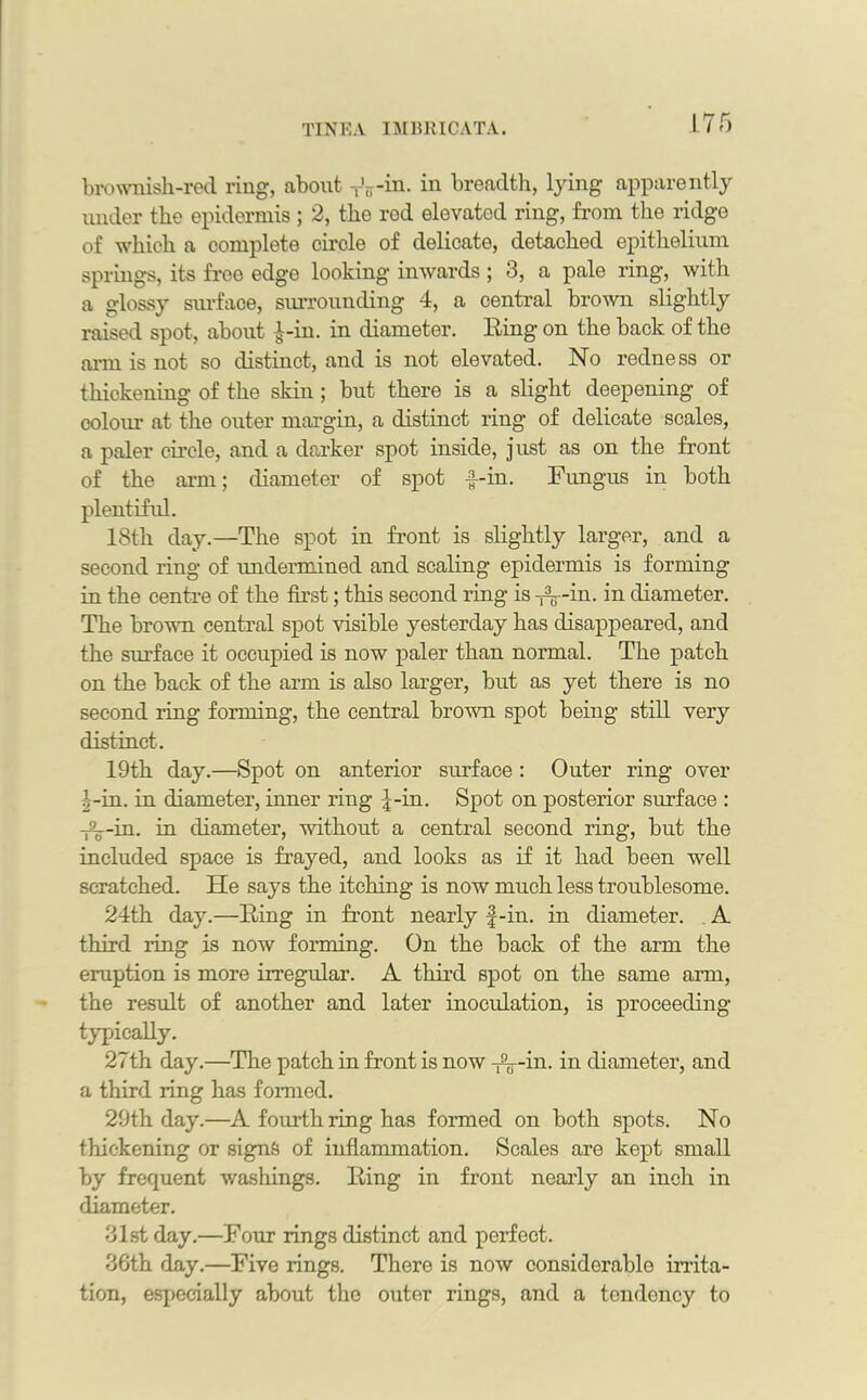 brownish-red ring, about T'^-in. in breadth, lying apparently under the epidermis ; 2, the rod elevated ring, from the ridge of which a complete circle of delicate, detached epithelium springs, its free edge looking inwards ; 3, a pale ring, with a glossy surface, surrounding 4, a central brown slightly raised spot, about J-in. in diameter. Eing on the back of the arm is not so distinct, and is not elevated. No redness or thickening of the skin; but there is a slight deepening of colour at the outer margin, a distinct ring of delicate scales, a paler circle, and a darker spot inside, just as on the front of the arm; diameter of spot f-in. Fungus in both plentiful. 18th day.—The spot in front is slightly larger, and a second ring of undermined and scaling epidermis is forming in the centre of the first; this second ring is -^--in. in diameter. The brown central spot visible yesterday has disappeared, and the surface it occupied is now paler than normal. The patch on the back of the arm is also larger, but as yet there is no second ring forming, the central brown spot being still very distinct. 19th day.—Spot on anterior surface: Outer ring over b-m. in diameter, inner ring f-in. Spot on posterior surface : -j^-in. in diameter, without a central second ring, but the included space is frayed, and looks as if it had been well scratched. He says the itching is now much less troublesome. 24th day.—Eing in front nearly f-in. in diameter. A third ling is now forming. On the back of the arm the eruption is more irregular. A third spot on the same arm, the result of another and later inoculation, is proceeding typically. 27th day.—The patch in front is now Arin. in diameter, and a third ring has formed. 29th day.—A fourth ring has formed on both spots. No thickening or signs of inflammation. Scales are kept small by frequent washings. Eing in front nearly an inch in diameter. 31st day.—Four rings distinct and perfect. 36th day.—Five rings. There is now considerable irrita- tion, especially about the outer rings, and a tendency to