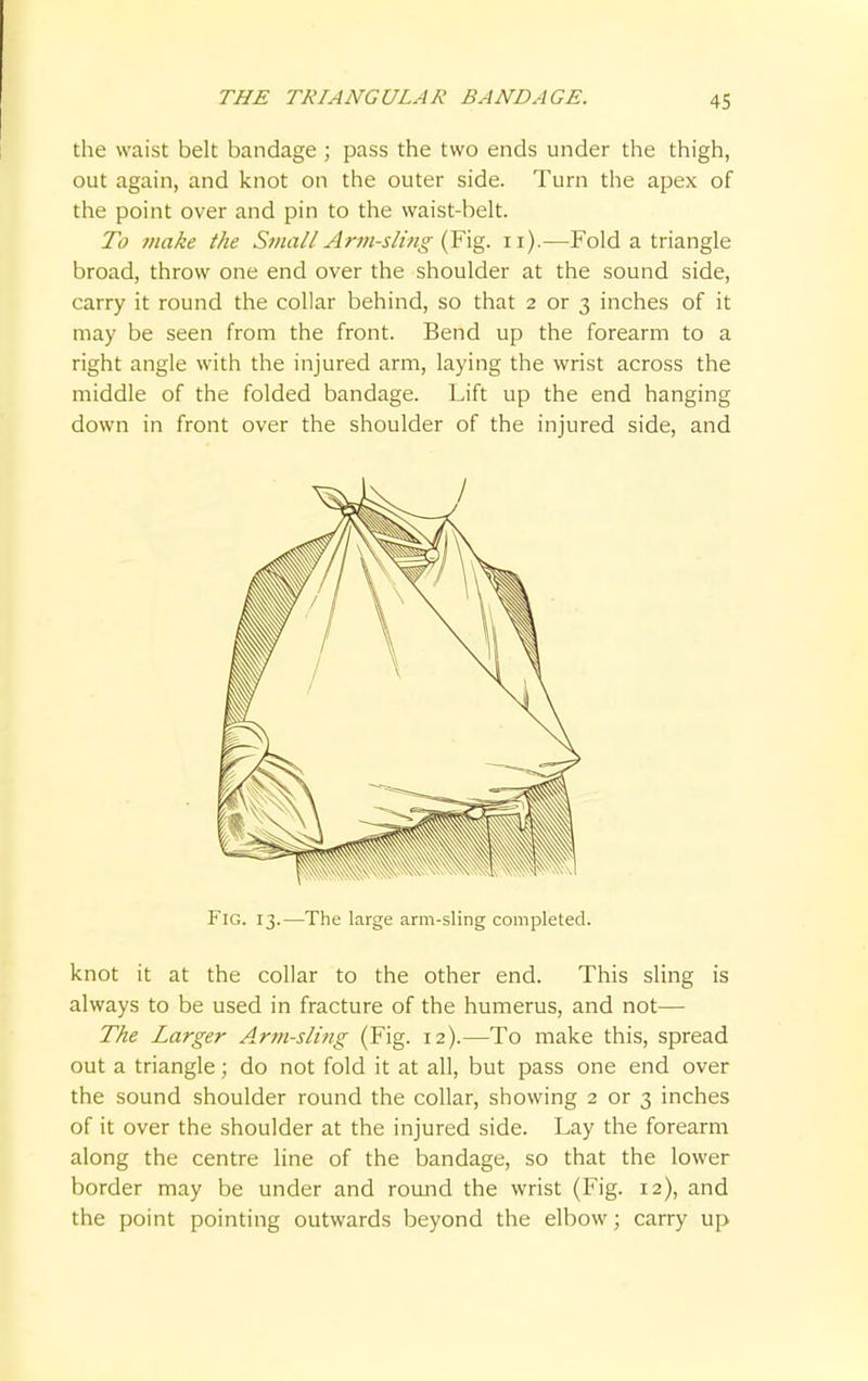 the waist belt bandage ; pass the two ends under the thigh, out again, and knot on the outer side. Turn the apex of the point over and pin to the waist-belt. To ?nake the Small Arm-sling (Fig. n).—Fold a triangle broad, throw one end over the shoulder at the sound side, carry it round the collar behind, so that 2 or 3 inches of it may be seen from the front. Bend up the forearm to a right angle with the injured arm, laying the wrist across the middle of the folded bandage. Lift up the end hanging down in front over the shoulder of the injured side, and Fig. 13.—The large arm-sling completed. knot it at the collar to the other end. This sling is always to be used in fracture of the humerus, and not— The Larger Arm-sling (Fig. 12).—To make this, spread out a triangle; do not fold it at all, but pass one end over the sound shoulder round the collar, showing 2 or 3 inches of it over the shoulder at the injured side. Lay the forearm along the centre line of the bandage, so that the lower border may be under and round the wrist (Fig. 12), and the point pointing outwards beyond the elbow; carry up