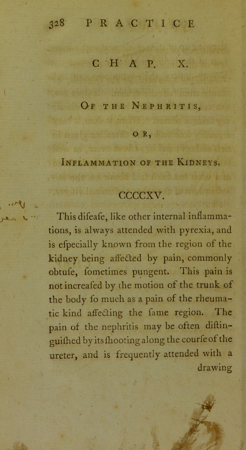 CHAP. X. Of the Nephritis, O R, Inflammation of the Kidneys. i -rJTj . ^ V. a ccccxv. , s t i ’■ Thisdifeafe, like other internal inflamma- tions, is always attended with pyrexia, and is efpecially known from the region of the kidney being affe&ed by pain, commonly obtufe, fometimes pungent. This pain is not increafed by the motion of the trunk of the body fo much as a pain of the rheuma- tic kind affe&ing the fame region. The pain of the nephritis may be often diftin- gViifhed by its fhooting along the courfeof the ureter, and is frequently attended with a drawing