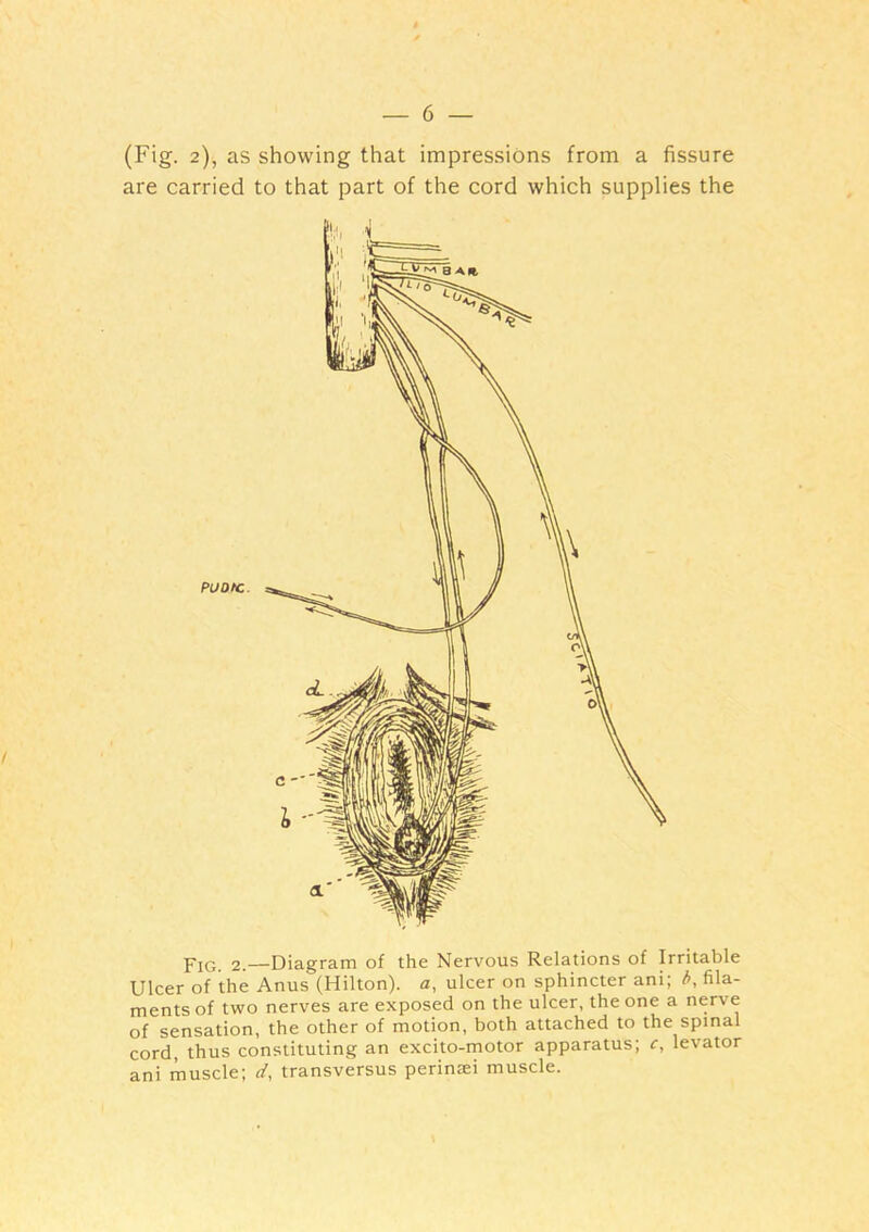 (Fig. 2), as showing that impressions from a fissure are carried to that part of the cord which supplies the Pjq 2.—Diagram of the Nervous Relations of Irritable Ulcer of the Anus (Hilton), a, ulcer on sphincter ani; b, fila- ments of two nerves are exposed on the ulcer, the one a nerve of sensation, the other of motion, both attached to the spinal cord, thus constituting an excito-motor apparatus; c, levator ani muscle; d, transversus perinaei muscle.