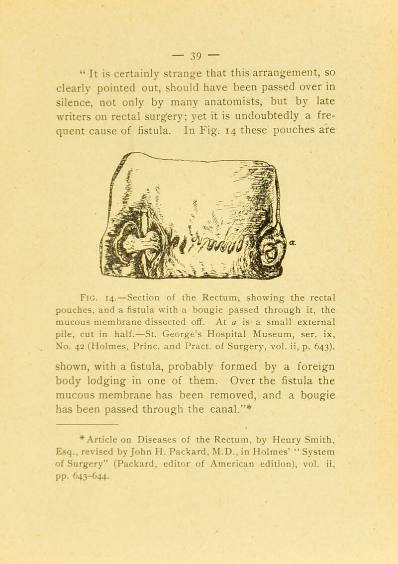 “ It is certainly strange that this arrangement, so clearly pointed out, should have been passed over in silence, not only by many anatomists, but by late writers on rectal surgery; yet it is undoubtedly a fre- quent cause of fistula. In Fig. 14 these pouches are Fig. 14.—Section of the Rectum, showing the rectal pouches, and a fistula with a bougie passed through it, the mucous membrane dissected off. At a is- a small external pile, cut in half.—St. George’s Hospital Museum, ser. ix. No. 42 (Holmes, Princ. and Pract. of Surgery, vol. ii, p. 643). shown, with a fistula, probably formed by a foreign body lodging in one of them. Over the fistula the mucous membrane has been removed, and a bougie has been passed through the canal.”* * Article on Diseases of the Rectum, by Henry Smith, Esq., revised by John H. Packard, M.D., in Holmes’ “ System of Surgery” (Packard, editor of American edition), vol. ii, pp. 643-644.