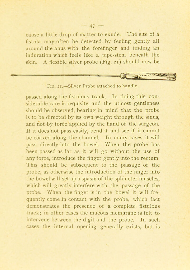 cause a little drop of matter to exude. The site of a fistula may often be detected by feeling gently all around the anus with the forefinger and finding an induration which feels like a pipe-stem beneath the skin. A flexible silver probe (Fig. 21) should now be Fig. 21.—Silver Probe attached to handle. passed along the fistulous track. In doing this, con- siderable care is requisite, and the utmost gentleness should be observed, bearing in mind that the probe is to be directed by its own weight through the sinus, and not by force'applied by the hand of the surgeon. If it does not pass easily, bend it and see if it cannot be coaxed along the channel. In many cases it will pass directly into the bowel. When the probe has been passed as far as it will go without the use of any force, introduce the finger gently into the rectum. This should be subsequent to the passage of the probe, as otherwise the introduction of the finger into the bowel will set up a spasm of the sphincter muscles, which will greatly interfere with the passage of the probe. When the finger is in the bowel it will fre- quently come .in contact with the probe, which fact demonstrates the presence of a complete fistulous track; in other cases the mucous membrane is felt to intervene between the digit and the probe. In such cases the internal opening generally exists, but is