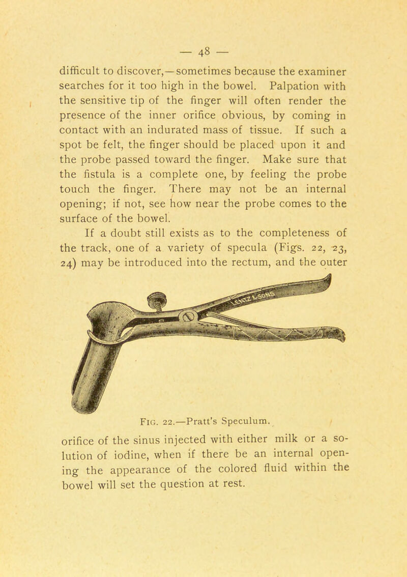 difficult to discover,—sometimes because the examiner searches for it too high in the bowel. Palpation with the sensitive tip of the finger will often render the presence of the inner orifice obvious, by coming in contact with an indurated mass of tissue. If such a spot be felt, the finger should be placed upon it and the probe passed toward the finger. Make sure that the fistula is a complete one, by feeling the probe touch the finger. There may not be an internal opening; if not, see how near the probe comes to the surface of the bowel. If a doubt still exists as to the completeness of the track, one of a variety of specula (Figs. 22, -23, 24) may be introduced into the rectum, and the outer Fig. 22.—Pratt’s Speculum. orifice of the sinus injected with either milk or a so- lution of iodine, when if there be an internal open- ing the appearance of the colored fluid within the bowel will set the question at rest.