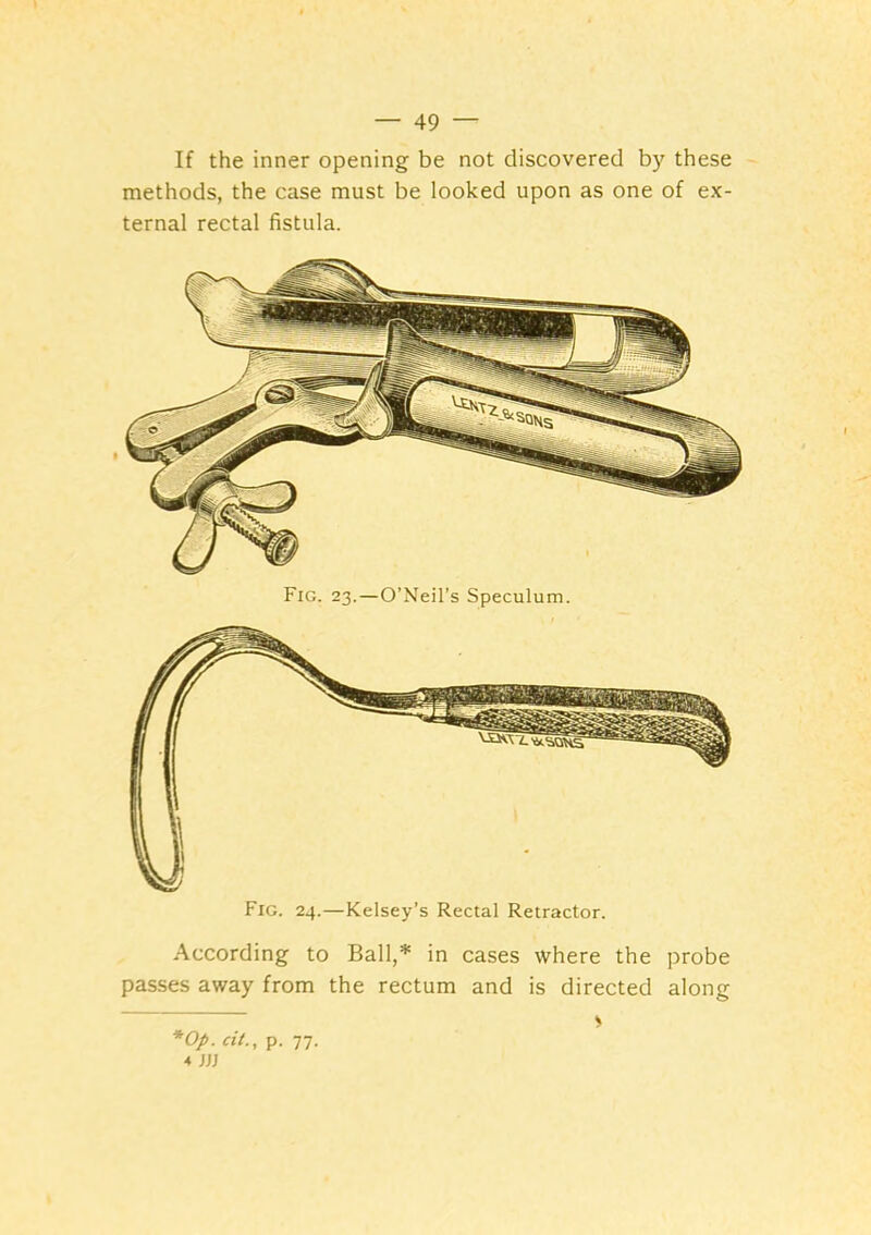 If the inner opening be not discovered by these methods, the case must be looked upon as one of ex- ternal rectal fistula. Fig. 24.—Kelsey’s Rectal Retractor. According to Ball,* in cases where the probe passes away from the rectum and is directed along *Op. cit., p. 77. 4 jjj