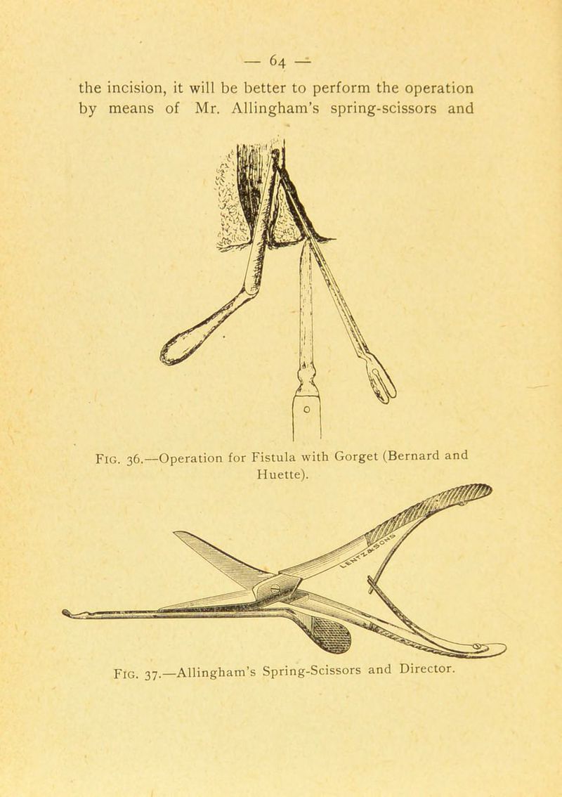 by means of Mr. Allingham’s spring-scissors and Fig. 36.—Operation for Fistula with Gorget (Bernard and Huette). Fig. 37.—Allingham’s Spring-Scissors and Director.