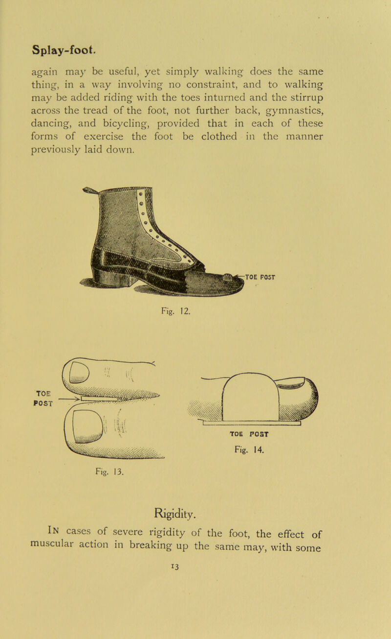 again may be useful, yet simply walking does the same thing, in a way involving no constraint, and to walking may be added riding with the toes inturned and the stirrup across the tread of the foot, not further back, gymnastics, dancing, and bicycling, provided that in each of these forms of exercise the foot be clothed in the manner previously laid down. POST Fig. 12. TOE POST Fig. 13. TOE POST Fig. 14. Rigidity. In ca.ses of severe rigidity of the foot, the effect of muscular action in breaking up the same may, with some