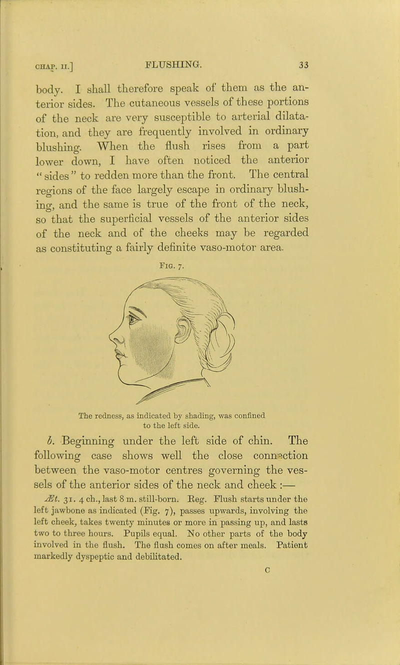 body. I shall therefore speak ol them as the an- terior sides. The cutaneous vessels of these portions of the neck are very susceptible to arterial dilata- tion, and they are frequently involved in ordinary bln shiner. When the flush rises from a part o . lower down, I have often noticed the anterior “ sides ” to redden more than the front. The central regions of the face largely escape in ordinary blush- ino\ and the same is true of the front of the neck, so that the superficial vessels of the anterior sides of the neck and of the cheeks may be regarded as constituting a fairly definite vaso-motor area. Fig. 7. The redness, as indicated by shading, was confined to the left side. b. Beginning under the left side of chin. The following case shows well the close connection between the vaso-motor centres governing the ves- sels of the anterior sides of the neck and cheek :— jEt. 31.4 ch., last 8 m. still-born. Reg. Flush starts under the left jawbone as indicated (Fig. 7), passes upwards, involving the left cheek, takes twenty minutes or more in passing up, and lasts two to three hours. Pupils equal. No other parts of the body involved in the flush. The flush comes on after meals. Patient markedly dyspeptic and debilitated. C