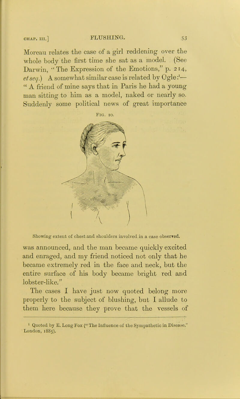 Moreau relates the case of a girl reddening over the whole body the first time she sat as a model. (See Darwin, The Expression of the Emotions,” p. 214, et se</.) A somewhat similar case is related by Ogle r1— “ A friend of mine says that in Paris he had a young man sitting to him as a model, naked or nearly so. Suddenly some political news of great importance Fig. 10. Showing extent of chest and shoulders involved in a case observed. was announced, and the man became quickly excited and enraged, and my friend noticed not only that he became extremely red in the face and neck, but the entire surface of his body became bright red and lobster-like.” The cases I have just now quoted belong more properly to the subject of blushing, but I allude to them here because they prove that the vessels of 1 Quoted by E. Long Fox (“ The Influence of the Sympathetic in Disease.” London, 1885).