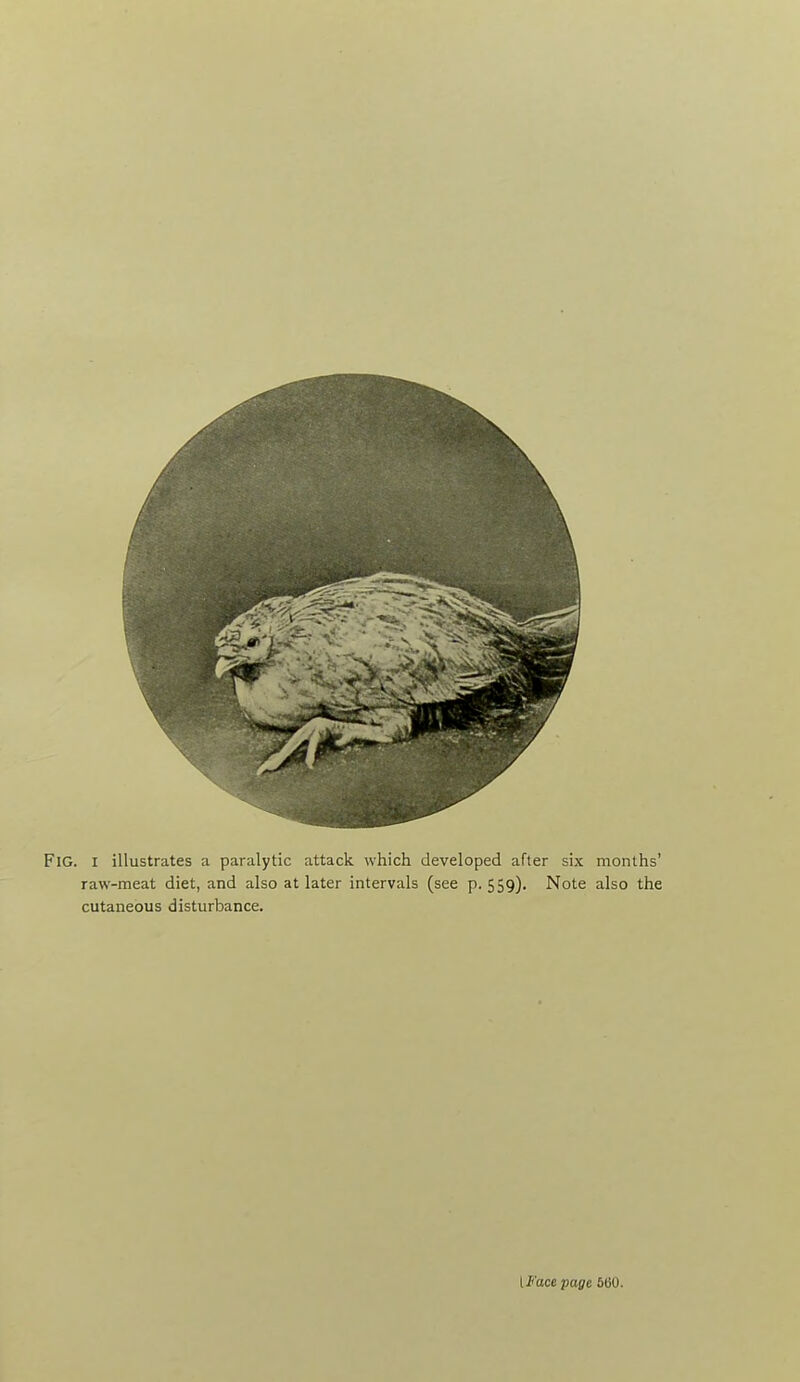 Fig. I illustrates a paralytic attack which developed after six months' raw-meat diet, and also at later intervals (see p. 559). Note also the cutaneous disturbance. IFace page 500.