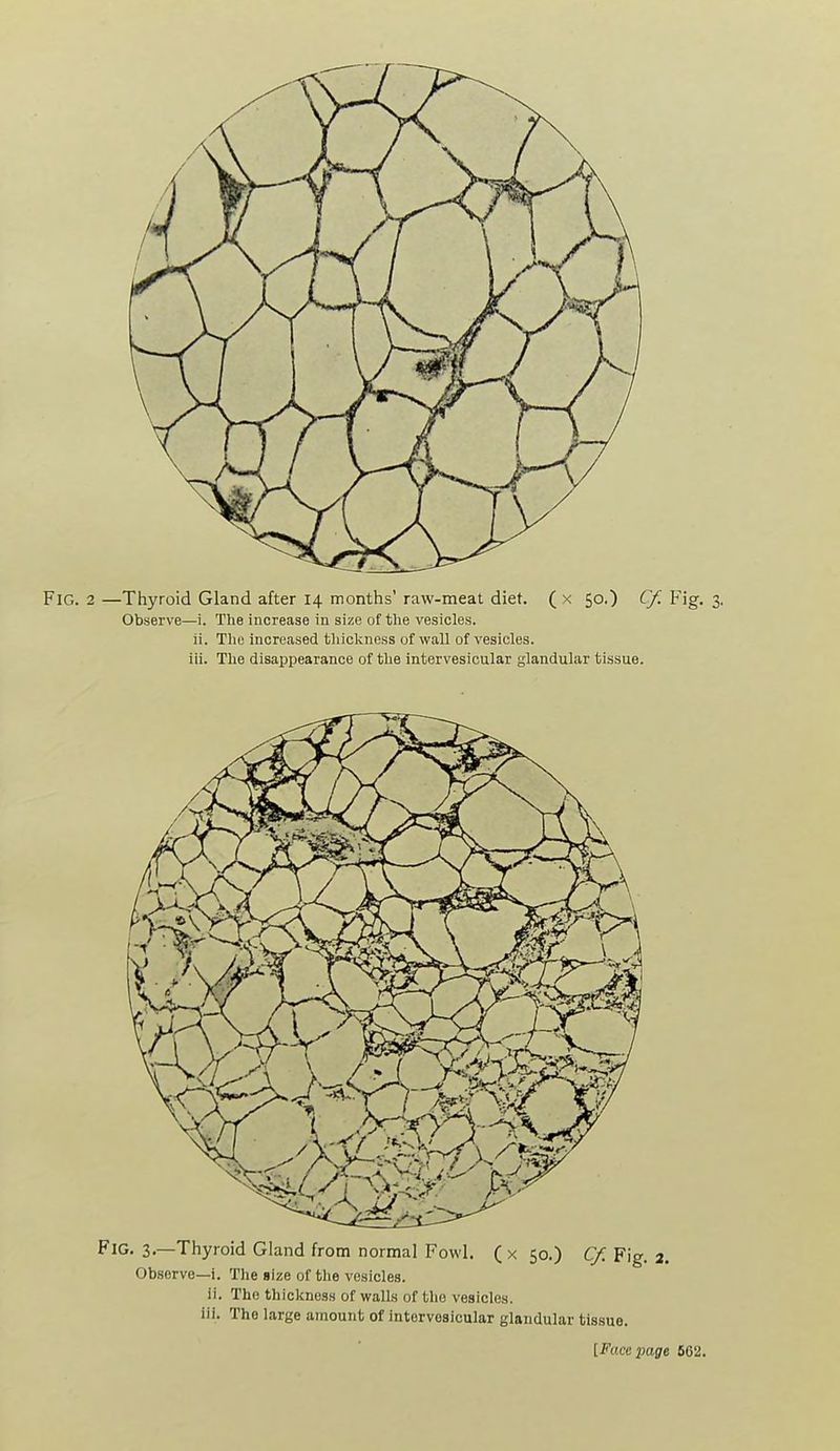 Fig. 2 —Thyroid Gland after 14 months' raw-meat diet. ( x 50.) Cf. Fig. 3. Observe—i. The increase in size of the vesicles. ii. Tlie increased thiclcness of wall of vesicles. iii. The disappearance of the intervesicular glandular tissue. Fig. 3.—Thyroid Gland from normal Fowl. ( x 50.) Cf. Fig. 3. Observe—i. The size of the vesicles. ii. The thicliness of walls of the vesicles, iii. The large amount of intervesicular glandular tissue. [i^'uccpajre 662.