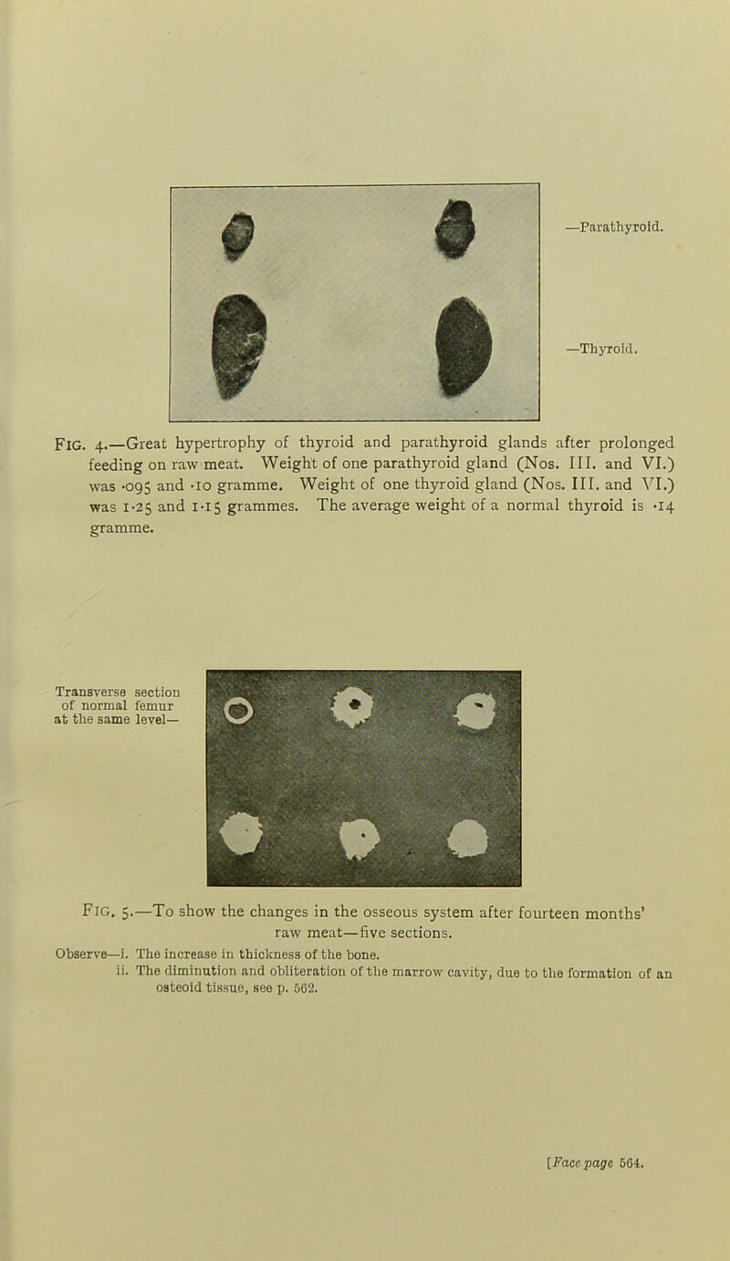 —Parathyroid. —Thyroid. Fig. 4.—Great hypertrophy of thyroid and parathyroid glands after prolonged feeding on raw meat. Weight of one parathyroid gland (Nos. III. and VI.) was -095 and -lo gramme. Weight of one thyroid gland (Nos. III. and Vl.) was 1-25 and I-I5 grammes. The average weight of a normal thyroid is -14 gramme. Transverse section of normal femur at the same level— Fig. 5.—To show the changes in the osseous system after fourteen months' raw meat—five sections. Observe—i. The Increase in thiclcness of the bone. ii. The diminution and obliteration of the marrow cavity, due to the formation of an osteoid tissue, see p. 562. [Face page 564.