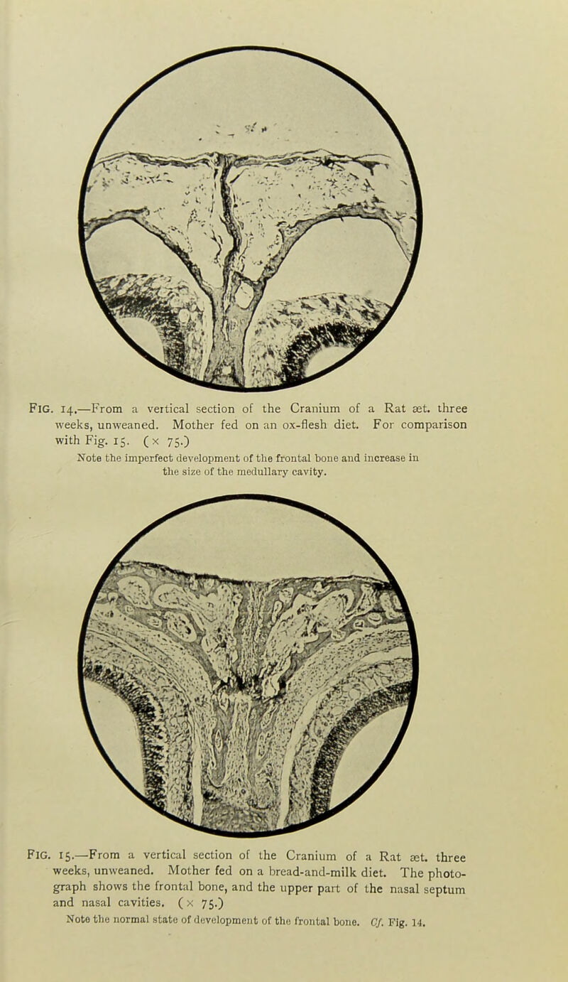 Fig. 14.—From a vertical section of the Cranium of a Rat set. three weeks, unweaned. Mother fed on an ox-flesh diet. For comparison with Fig. 15. (x 75.) Note the imperfect development of the frontal bone and increase in the size of the medullary cavity. Fig. 15.—From a vertical section of the Cranium of a Rat set. three weeks, unweaned. Mother fed on a bread-and-milk diet. The photo- graph shows the frontal bone, and the upper part of the nasal septum and nasal cavities, (x 75.)