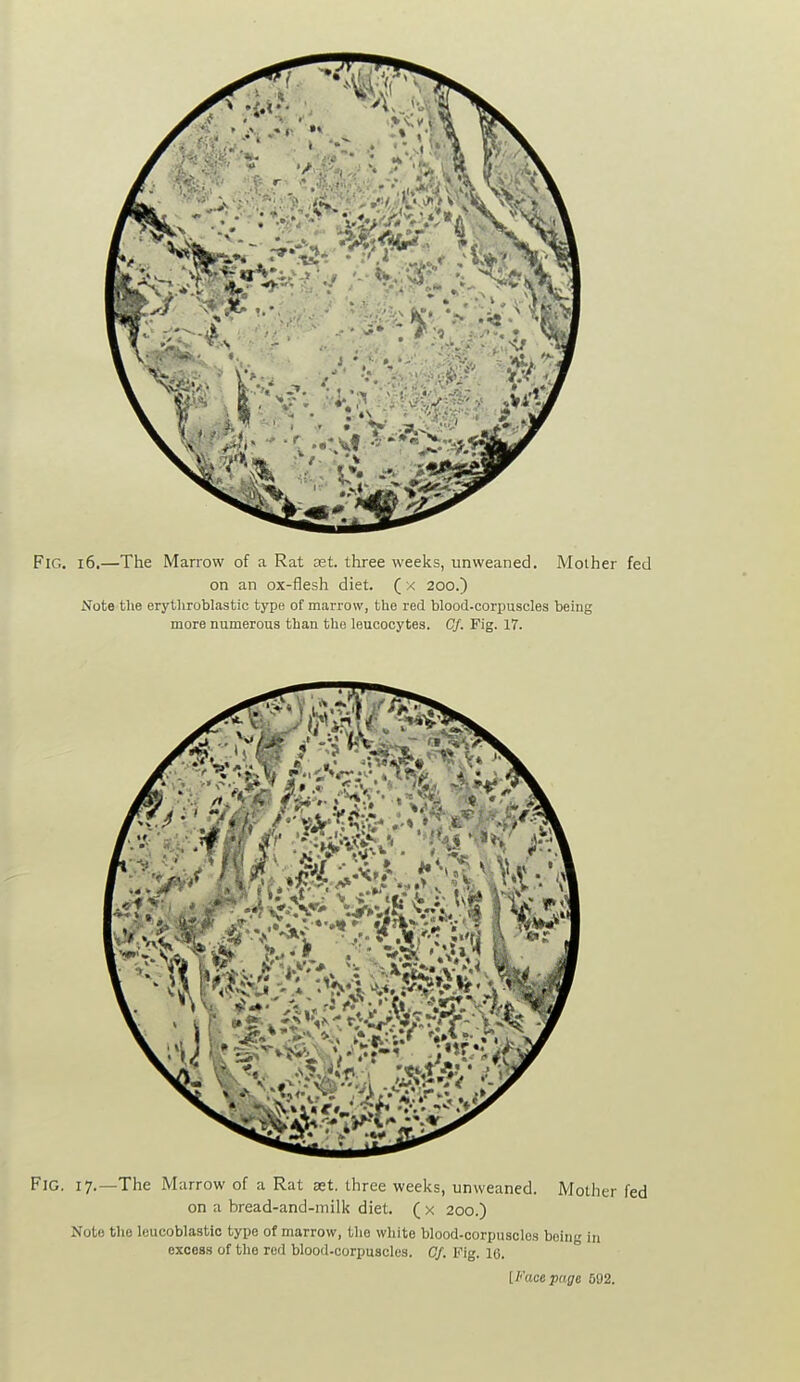 Fig. i6.—The Marrow of a Rat vet three weeks, unweaned. Mother fed on an ox-flesh diet. ( x 200.) Note the erythroblastic type of marrow, the red blood-corpuscles being more numerous than the leucocytes. Cf. Fig. 17. Fig. 17.—The Marrow of a Rat ast. three weeks, unweaned. Mother fed on a bread-and-milk diet. ( x 200.) Note the leucoblastio type of marrow, the white blood-corpuscles being in excess of the rod blood-corpuscles. Cf. Fig. 10.