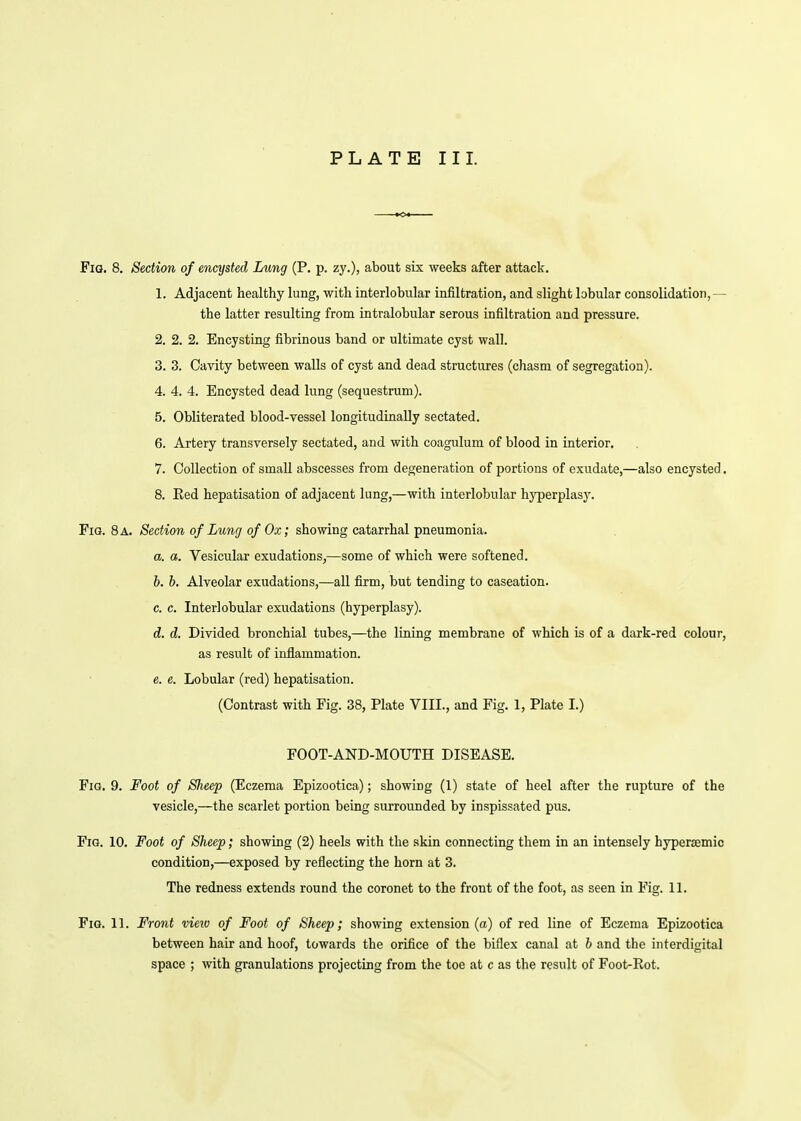 Fig. 8. Section of encysted Lung (P. p. zy.), about six weeks after attack. 1. Adjacent healthy lung, with interlobular infiltration, and slight lobular consolidation,— the latter resulting from intralobular serous infiltration and pressure. 2. 2. 2. Encysting fibrinous band or ultimate cyst wall. 3. 3. Cavity between walls of cyst and dead structures (cliasm of segregation). 4. 4. 4. Encysted dead lung (sequestrum). 5. Obliterated blood-vessel longitudinally sectated. 6. Artery transversely sectated, and with coagulum of blood in interior. 7. Collection of small abscesses from degeneration of portions of exudate,—also encysted. 8. Eed hepatisation of adjacent lung,—with interlobular hyperplasy. Fig. 8 a. Section of Lung of Ox; showing catarrhal pneumonia. a. a. Vesicular exudations,—some of which were softened. b. b. Alveolar exudations,—all firm, but tending to caseation. c. c. Interlobular exudations (hyperplasy). d. d. Divided bronchial tubes,—the lining membrane of which is of a dark-red colour, as result of inflammation. e. e. Lobular (red) hepatisation. (Contrast with Fig. 38, Plate VIII., and Fig. 1, Plate I.) FOOT-AND-MOUTH DISEASE. Fig. 9. Foot of Sheep (Eczema Epizootica); showing (1) state of heel after the rupture of the vesicle,—the scarlet portion being surrounded by inspissated pus. Fig. 10. Foot of Sheep; showing (2) heels with the skin connecting them in an intensely hypersemic condition,—exposed by reflecting the horn at 3. The redness extends round the coronet to the front of the foot, as seen in Fig. 11. Fig. 11. Front vieio of Foot of Sheep; showing extension (a) of red line of Eczema Epizootica between hair and hoof, towards the orifice of the biflex canal at b and the interdigital space ; with granulations projecting from the toe at c as the result of Foot-Rot.