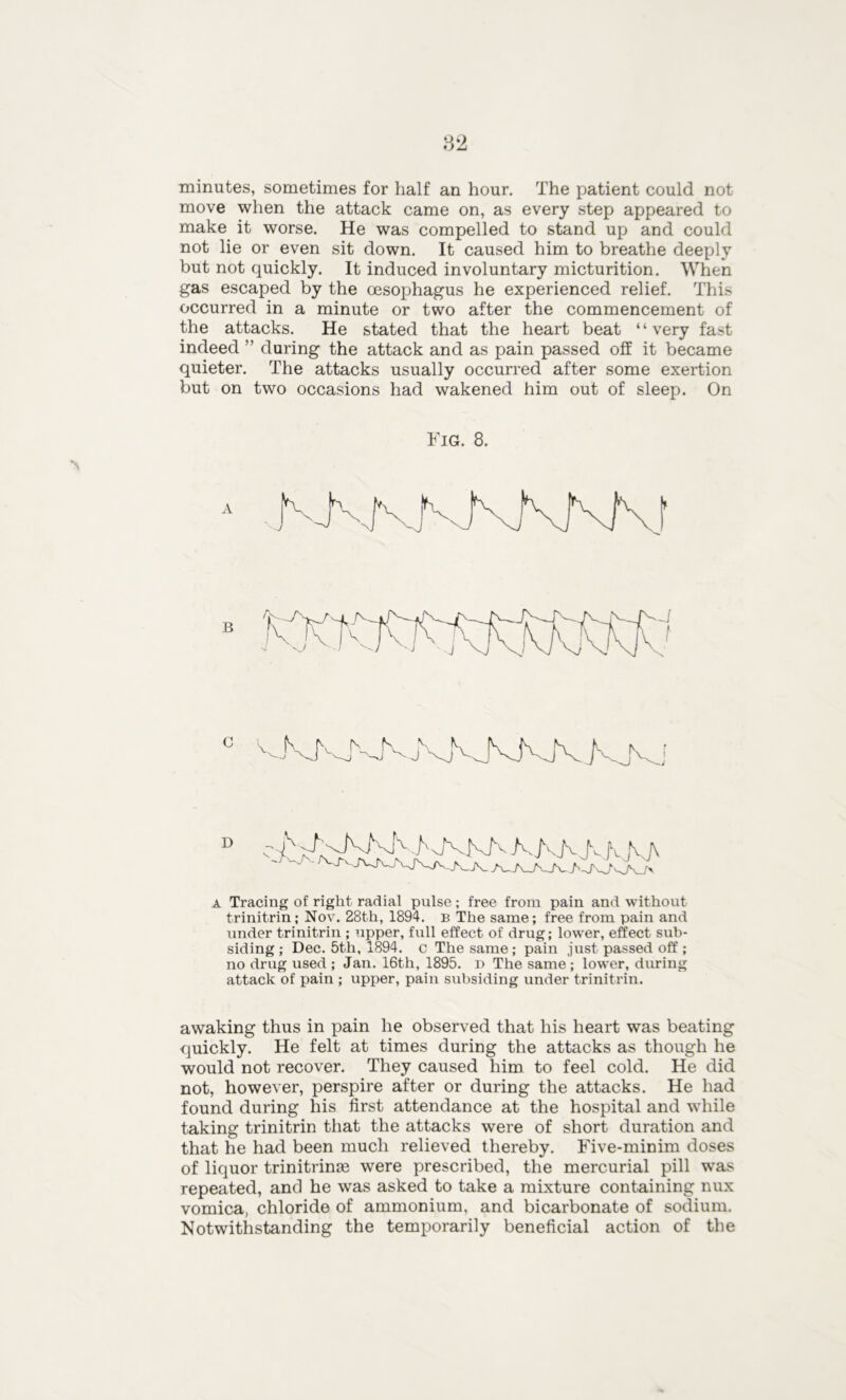 minutes, sometimes for half an hour. The patient could not move when the attack came on, as every step appeared to make it worse. He was compelled to stand up and could not lie or even sit down. It caused him to breathe deeply but not quickly. It induced involuntary micturition. When gas escaped by the oesophagus he experienced relief. This occurred in a minute or two after the commencement of the attacks. He stated that the heart beat ‘ ‘ very fast indeed ” during the attack and as pain passed off it became quieter. The attacks usually occurred after some exertion but on two occasions had wakened him out of sleep. On Fig. 8. a Tracing of right radial pulse; free from pain and without trinitrin; Nov. 28th, 1894. b The same; free from pain and under trinitrin ; upper, full effect of drug; lower, effect sub- siding ; Dec. 5th, 1894. c The same; pain just passed off ; no drug used ; Jan. 16th, 1895. D The same ; lower, during attack of pain ; upper, pain subsiding under trinitrin. awaking thus in pain he observed that his heart was beating quickly. He felt at times during the attacks as though he would not recover. They caused him to feel cold. He did not, however, perspire after or during the attacks. He had found during his first attendance at the hospital and while taking trinitrin that the attacks were of short duration and that he had been much relieved thereby. Five-minim doses of liquor trinitrinae were prescribed, the mercurial pill was repeated, and he was asked to take a mixture containing nux vomica, chloride of ammonium, and bicarbonate of sodium. Notwithstanding the temporarily beneficial action of the