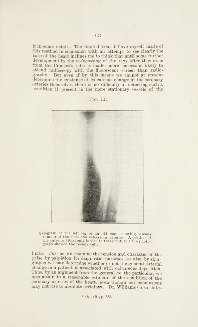 la it in some detail. The limited trial I have myself made of this method in connexion with an attempt to see clearly the base of the heart inclines me to think that until some further development in the re-focussing of the rays after they issue from the Crookes’s tube is made, more success is likely to attend radioscopy with the fluorescent screen than radio- graphy. But even if by this means we cannot at present determine the existence of calcareous change in the coronary arteries themselves there is no difficulty in detecting such a condition if present in the more stationary vessels of the Fig. 11. L Skiagram of the left leg of an old man, showing osseous tumour of the tibia and calcareous arteries. A portion of the anterior tibial only is seen in this print, but the photo- graph showed the vessels well. limbs. Just as we examine the tension and character of the pulse by palpation for diagnostic purposes, so also by skia- graphy we may determine whether or not the general arterial change in a patient is associated with calcareous deposition. Thus, by an argument from the general to the particular, we may attain to a reasonable estimate of the condition of the coronary arteries of the heart, even though our conclusions may not rise to absolute certainty. Dr. Williams4 also states